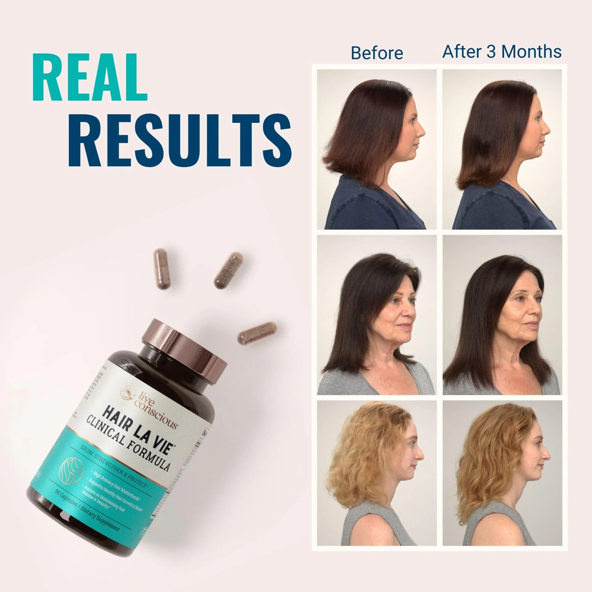 Hair La Vie Live Conscious Clinical Formula Hair Vitamins Capsule with Biotin and Saw Palmetto - Healthy Hair and Whole-Body Wellness (2-Pack) - Image 8