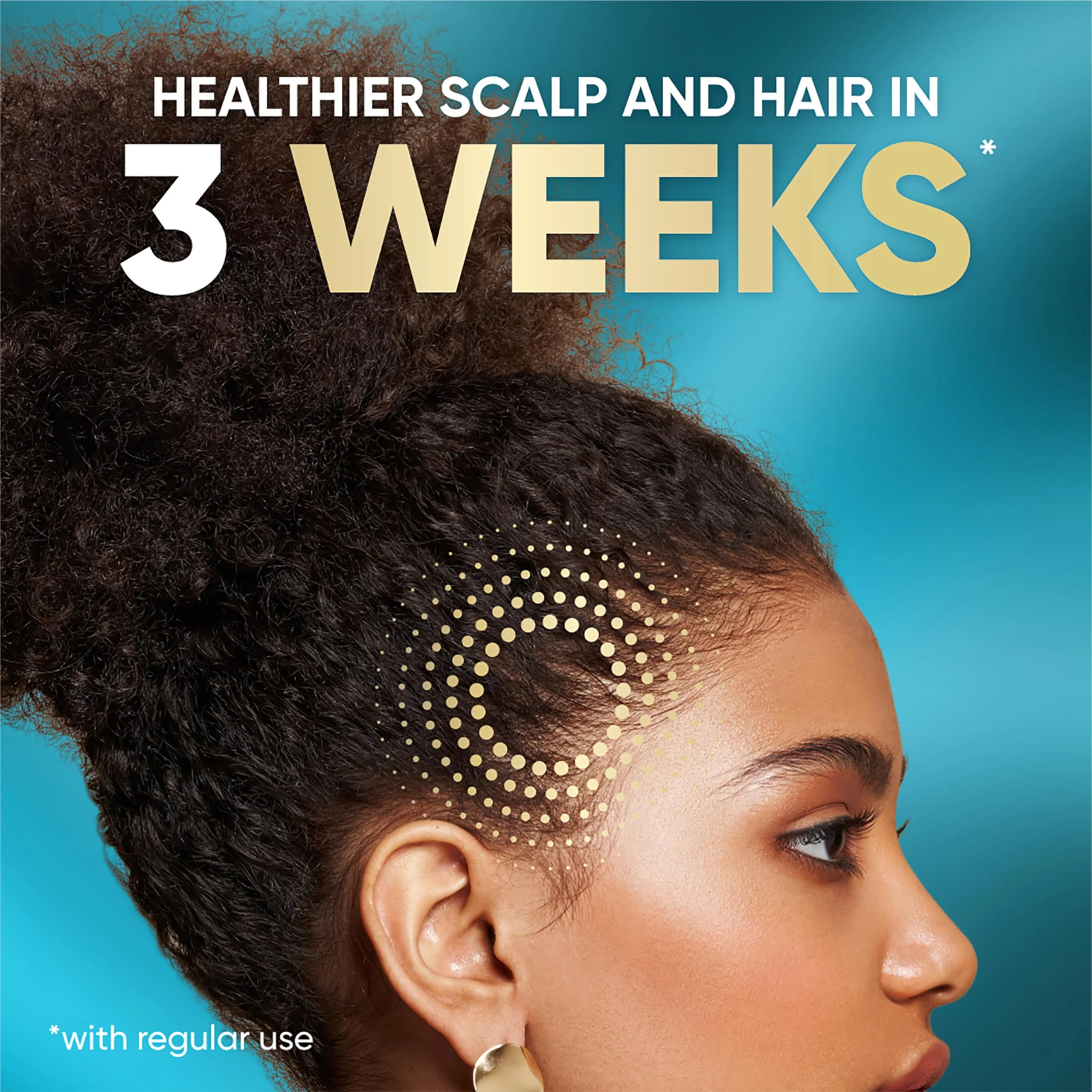 Head and Shoulders Scalp Cream Treatment, Daily Moisture, Anti Dandruff, Royal Oils Collection with Coconut Oil, Scalp Care for Natural and Curly Hair, 5.0 fl oz - Image 6