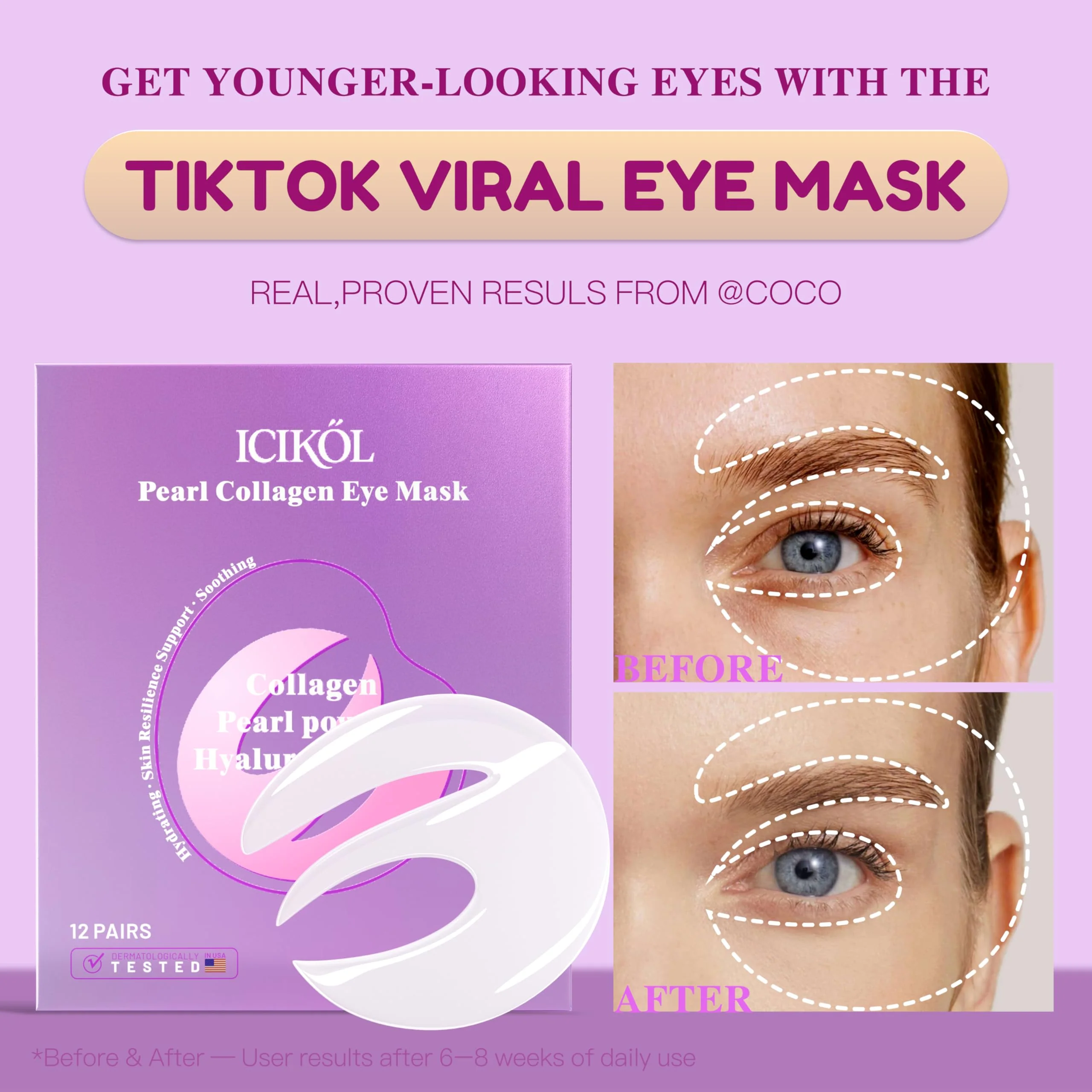 ICIKOL Under Eye Patches with Collagen, Eye Patches for Puffy Eyes and Dark Circles, 360° Under Eye Mask for Puffiness, Wrinkles, Fine Lines, Gifts for Women - Skin Care, 12 Pairs (White) - Image 6