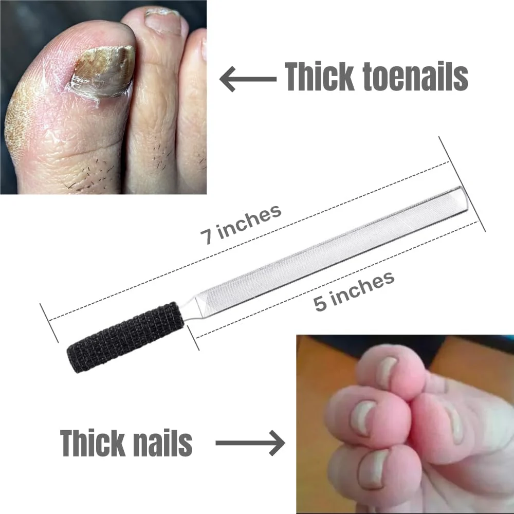 IDOU Toe Nail Files for Thick Nails,Stainless Steel 4 Sides 7 inch Length,Nail Files for Men Seniors & Dogs - Image 3