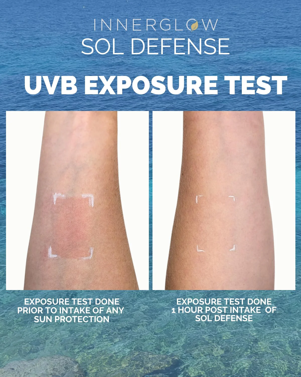 Inner Glow Sol Defense Gummies – Dermatologist & Plastic Surgeon-Formulated Skin Resilience Vitamin Supplement with Polypodium Leucotomos & Niacinamide, Passion Fruit Flavor, 60 Sugar-Free Gummies - Image 9