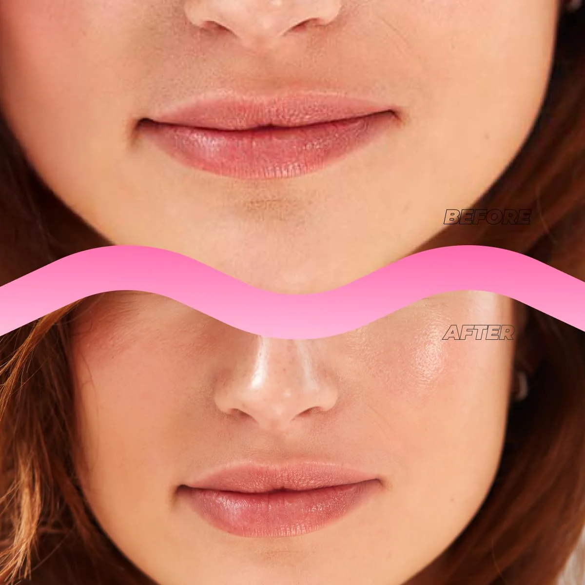 Instant Lip Filler Mask for Plumped Lips in 30 Mins with Vegan Collagen & Hyaluronic Acid - 3 Pack Korean Lip Mask Patches with 400 Dissolving Micro-Darts Tech for Instant & Long-Lasting Results - Image 8