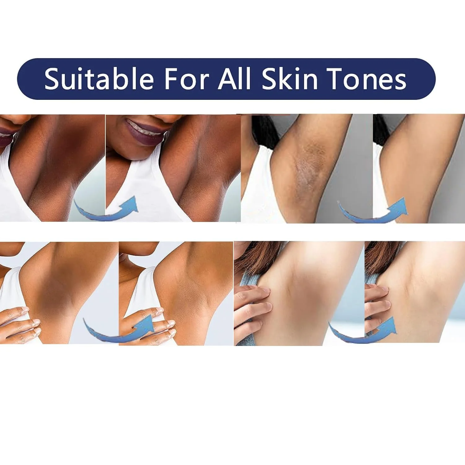 Intimate Areas Skin Lightening Cream Bleaching Cream For Body Sensitive Intimate Area, Private Parts, Underarm, Knees, Elbows, Inner Thigh, Bikini Areas, Bikini Line, Natural Skin Whitening. - Image 6