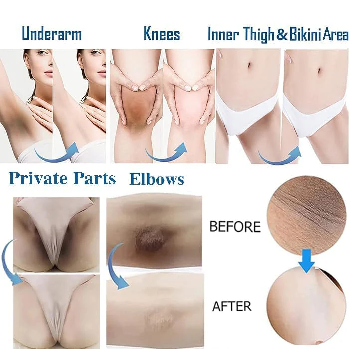 Intimate Areas Skin Lightening Cream Bleaching Cream For Body Sensitive Intimate Area, Private Parts, Underarm, Knees, Elbows, Inner Thigh, Bikini Areas, Bikini Line, Natural Skin Whitening. - Image 8