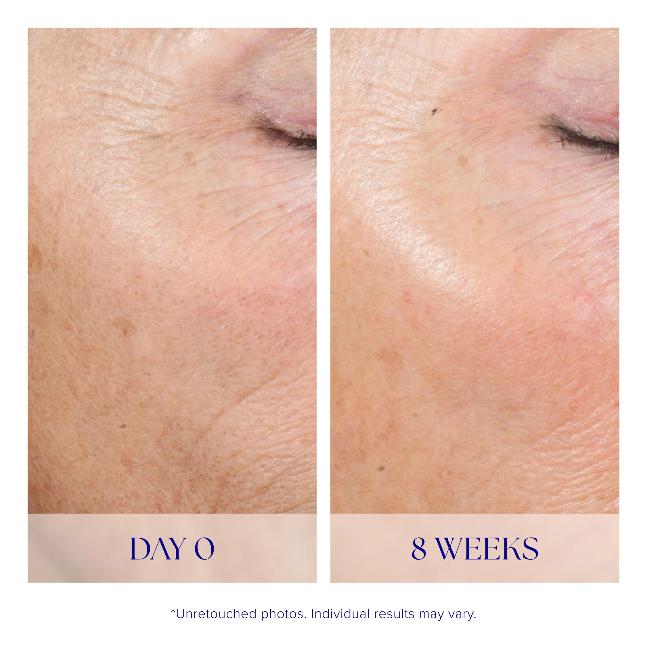 iS CLINICAL Active Peel System, two-step gentle at-home peel system for face Exfoliation - Image 4