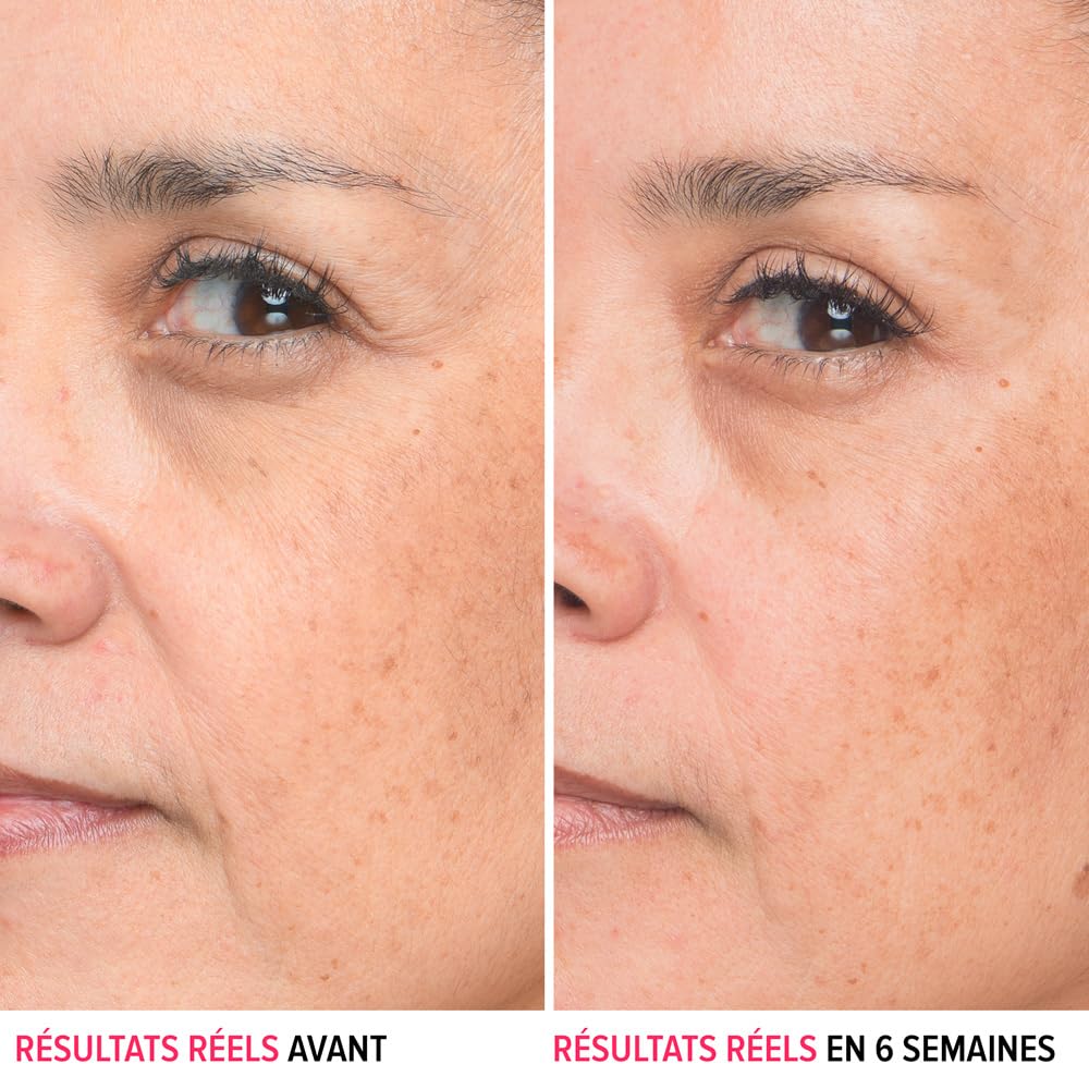 IT Cosmetics Bye Bye Lines Hyaluronic Acid Serum for Face - Hydrating Anti-Aging Facial Serum With Peptide & Vitamin B5, Visibly Plumps Skin, Smooths Look of Fine Lines, For All Skin Types - 1 fl oz - Image 12