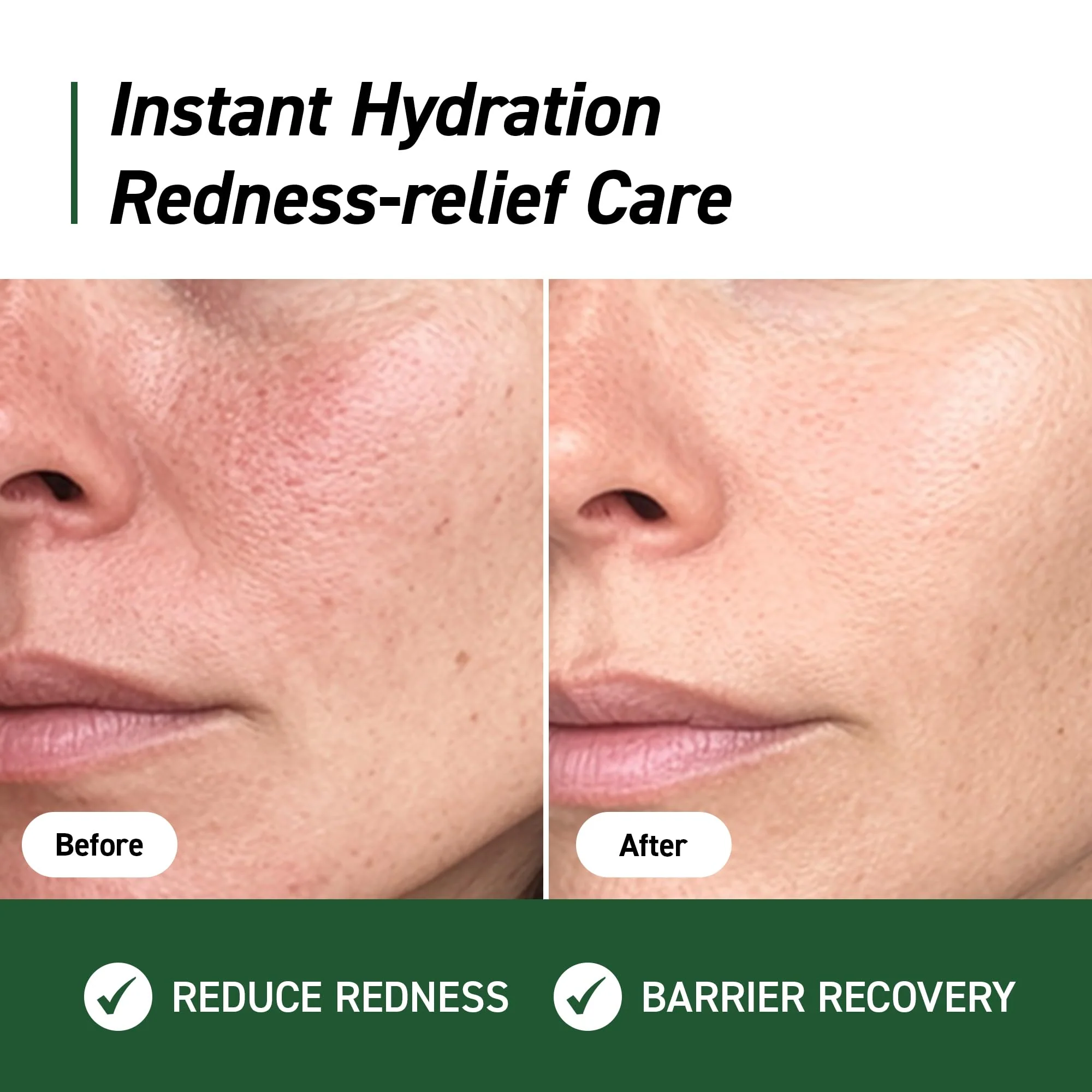 IVOSKIN Cica Redness Relief Treatment Cream, Soothing & Hydrating Green Correcting Moisturizer with Madecassoside, Helps Repair Skin Barrier for Sensitive Skin, Vegan, Korean Skincare (1.76oz / 50g) - Image 7