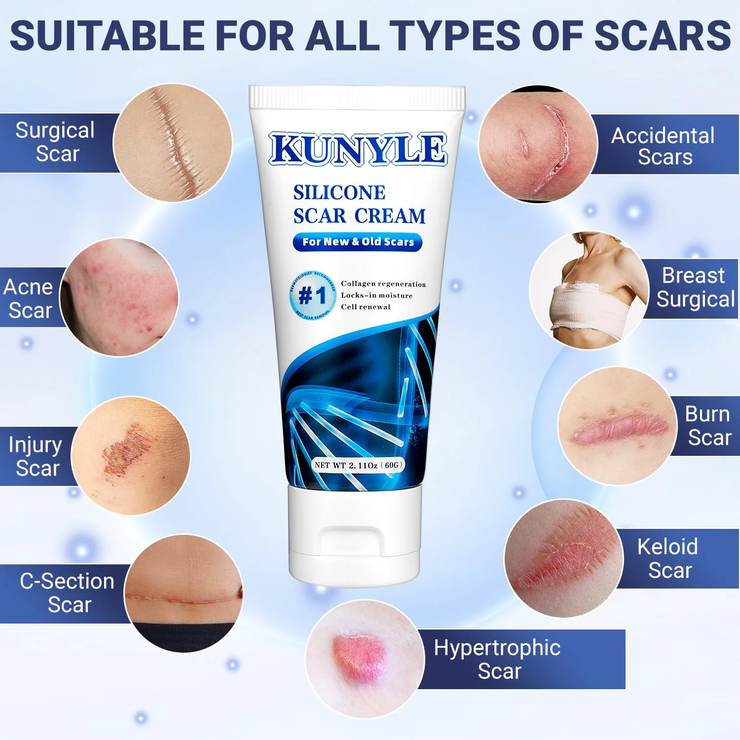 Kunyle Scar Cream, Silicone Scar Gel, Advanced Scar Removal Cream for Surgical Scars, Stretch Marks Removal, Keloid Bump Removal, Old and New Scars 2.11 Oz (60g) - Image 7