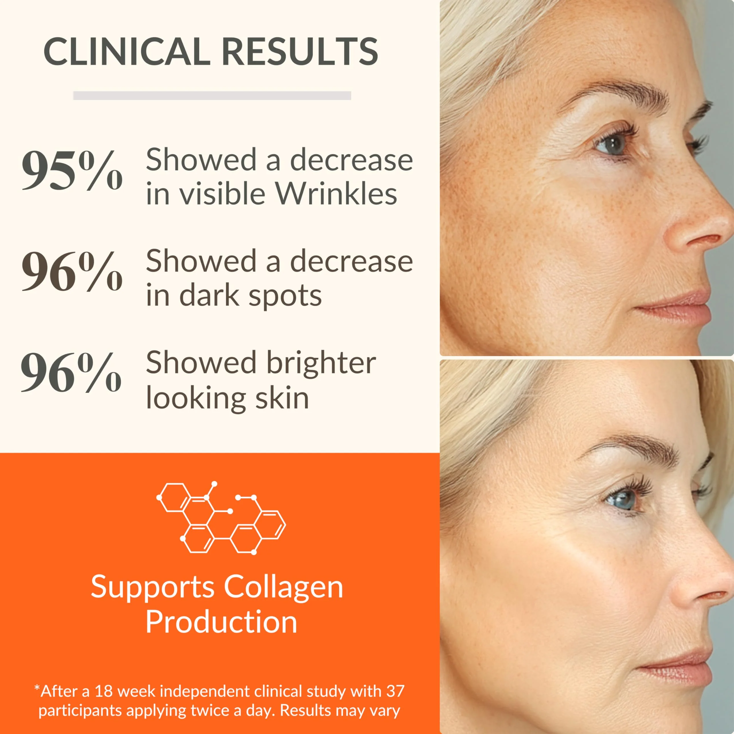 LeVaye Vitamin C Serum, Anti-Aging Face Serum – 15% Vitamin C, Ferulic Acid, Niacinamide, Hyaluronic Acid, Peptides, Ceramides – Targets Wrinkles, Fine Lines, Dark Spots, Enlarged Pores, Dry Skin - Image 8