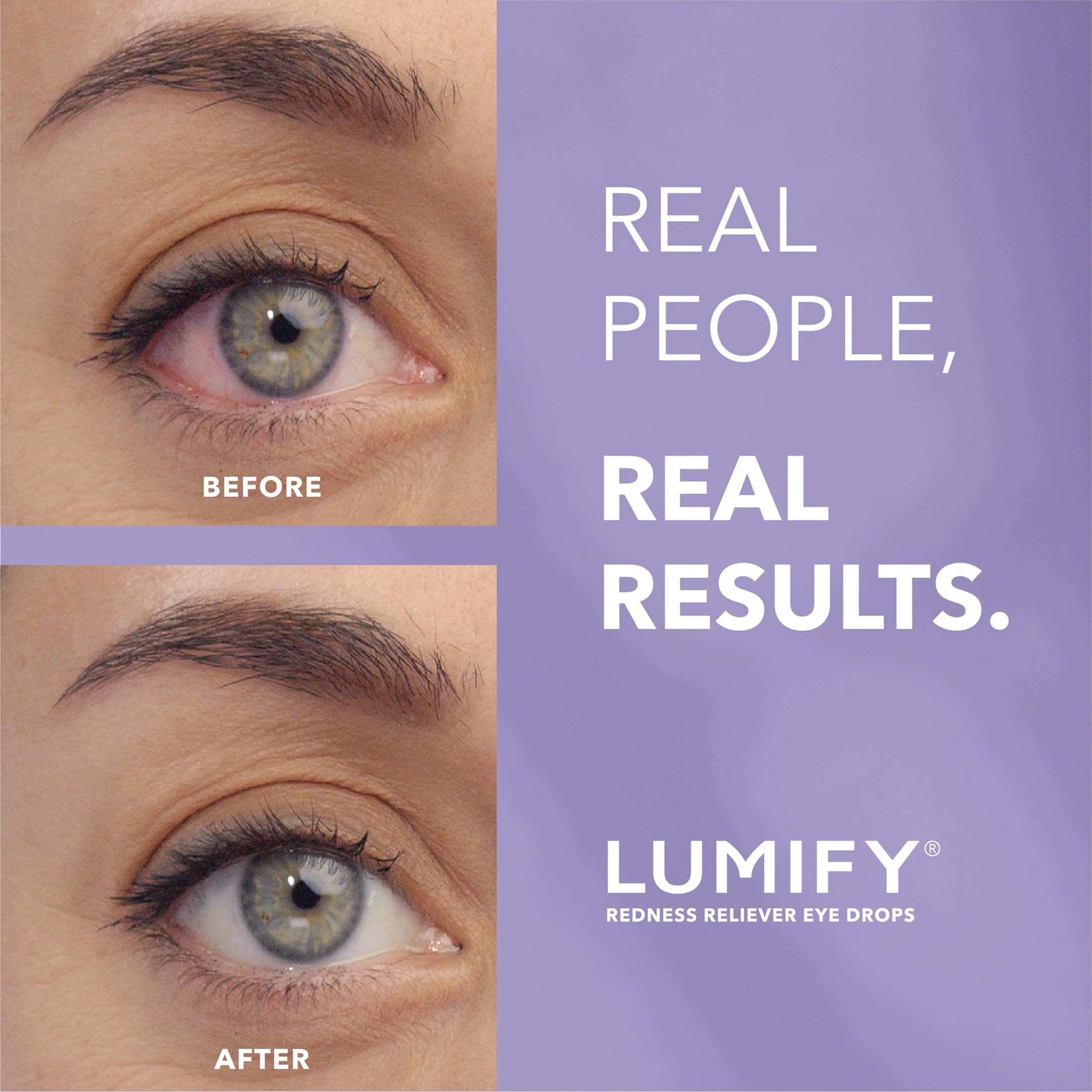 LUMIFY Eye Drops for Red Eyes, Redness Reliever for Brighter Looking Eyes, Works in 1 Minute & Lasts Up to 8 Hours, Eye Drops, 0.08 Fl Oz (2.5 mL) - Image 2