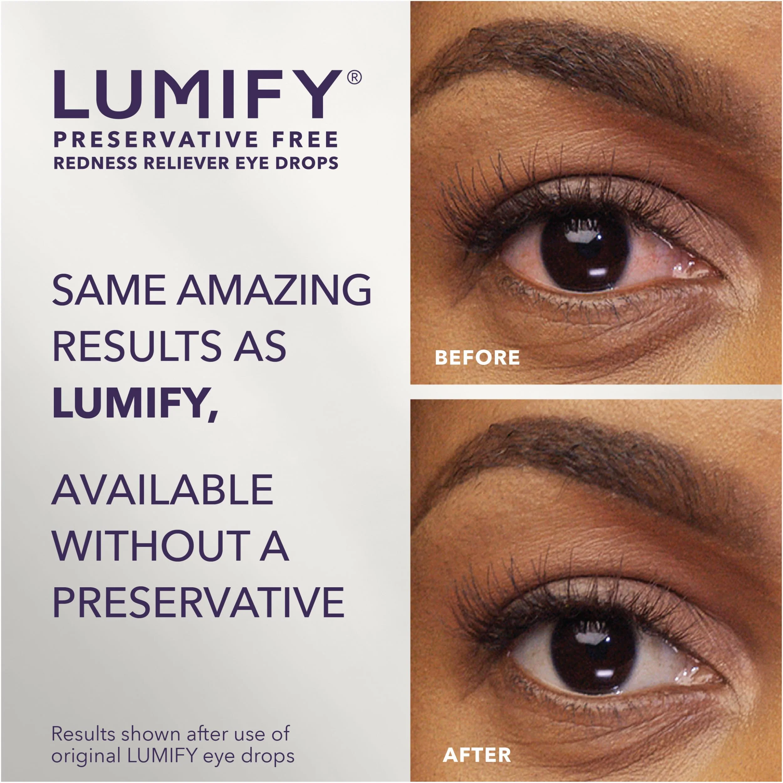 LUMIFY Preservative Free Eye Drops for Red Eyes, Redness Reliever for Sensitive Eye, Brighter and Whiter Looking Eyes, Works in 1 Minute & Lasts Up to 8 Hours, 20 Single-Use Vials - Image 2