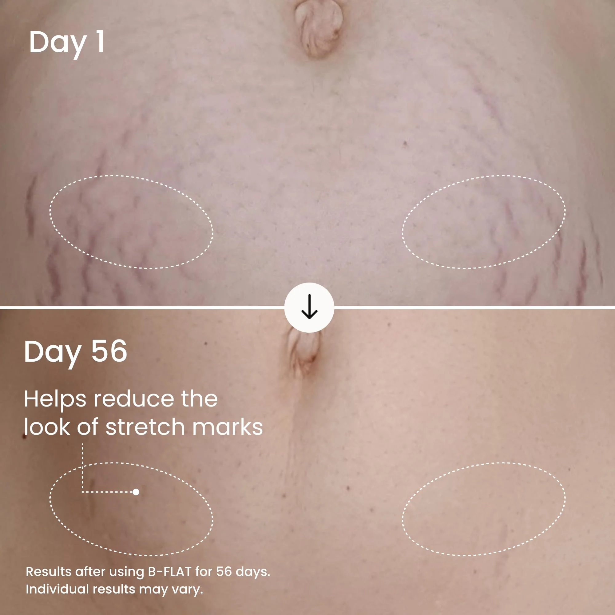 MAËLYS B-FLAT Belly Firming Cream for Women - Skin Tightening & Moisturizing Treatment with Shea Butter & Bentonite Clay - Smooths Look of Stretch Marks - Postpartum Body Care (3.4 Fl Oz) - Image 9