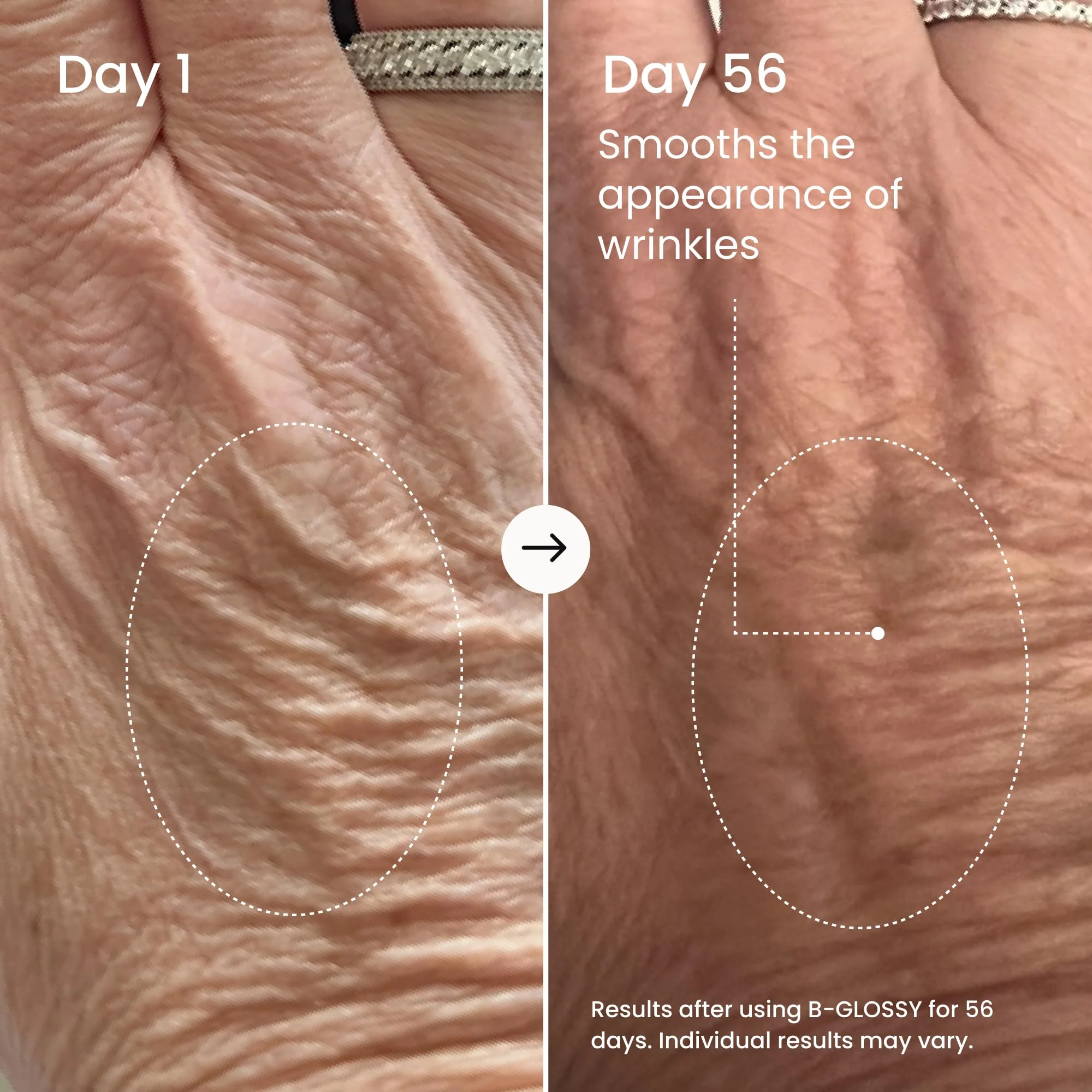 MAËLYS B-GLOSSY Smoothing Body Serum for Women - Hyaluronic Acid & Peptide Formula - Helps Reduce the Look of Wrinkles, Texture & Crepey Skin - Lightweight, Fast-Absorbing Anti-Aging Serum (3.4 Fl Oz) - Image 7