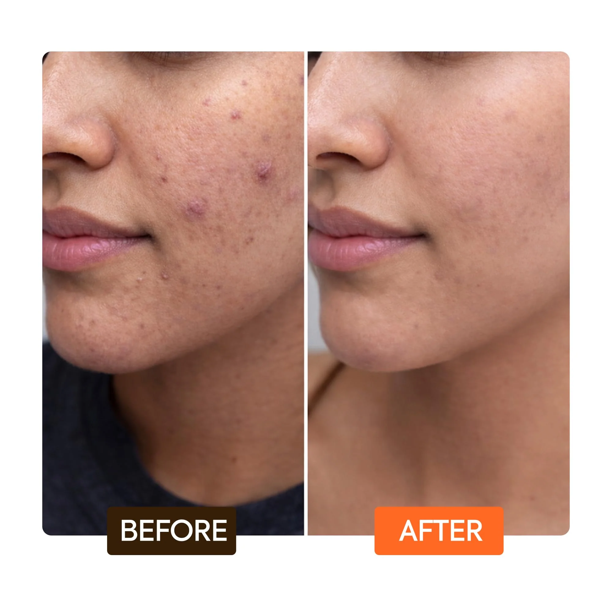 Makari Naturalle Carotonic Extreme Brightening Serum SPF15 (1.7 oz) | Helps Improve the Look of Blemishes & Uneven Areas | Brightening & Smoothing Formula with Antioxidant Support - Image 3