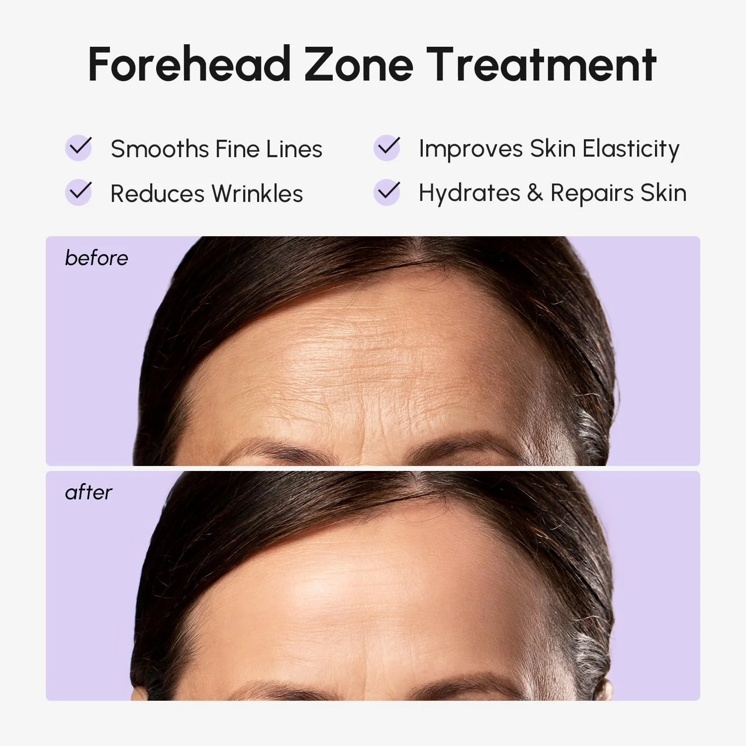 MAREE Forehead Wrinkle Patches – Collagen Wrinkle Patches with Retinol & Hyaluronic Acid for Face Lift – Fine Lines Deep Forehead Wrinkles Treatment Remover – Face Tape for Wrinkles Between Eyebrows - Image 7