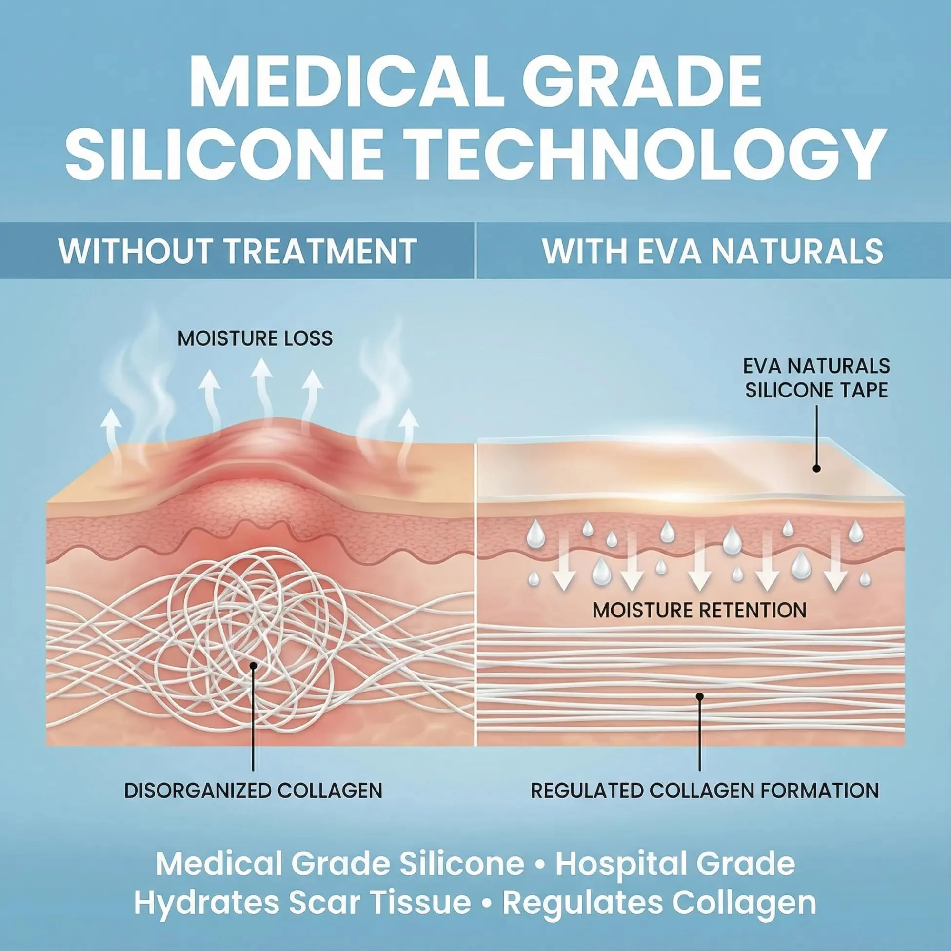 Medical Grade Silicone Scar Tape 1.6" x 120" – Reusable Sheets Roll for C Section, Keloid, Tummy Tuck & Surgical Scar Removal – Burn Scar Treatment Strips - Image 8