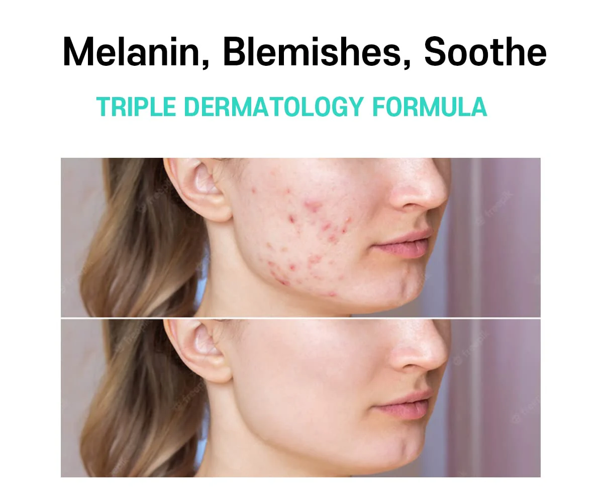 Melasma Treatment for Face Cream - Dark Spot Remover Centella Asiatica - Korean Skin Care Beauty Products 40ml/1.35 fl.oz - Image 6