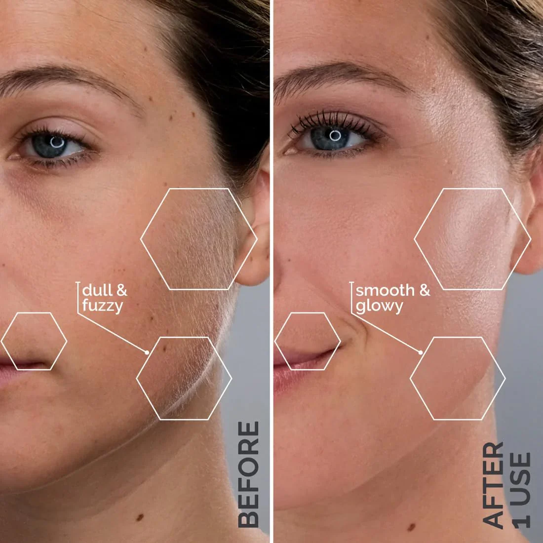 Michael Todd Beauty Sonicsmooth Pro+ Dermaplane Razor Blade Refills - 8 Dermaplaning Blades - 2 Month Supply - Device Not Included - Image 7