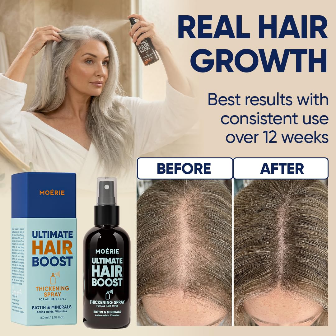 Moerie Hair Growth Serum Spray for Men and Women, Hair Loss Solution with Biotin and Rosemary, Thickening Serum for Hair Regrowth and Thinning Hair - Ultimate Scalp and Growth Care - Image 4