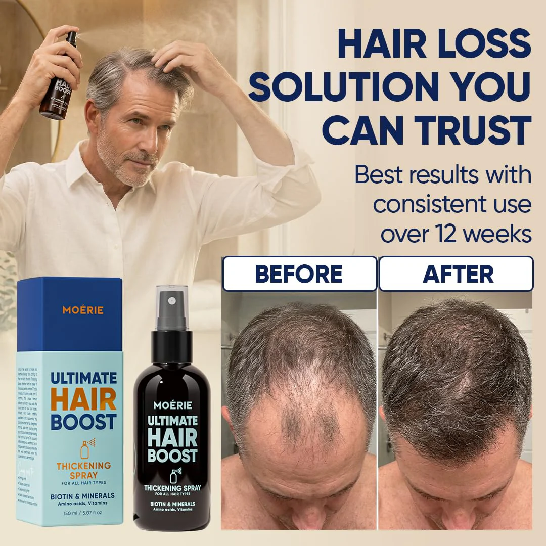 Moerie Hair Growth Serum Spray for Men and Women, Hair Loss Solution with Biotin and Rosemary, Thickening Serum for Hair Regrowth and Thinning Hair - Ultimate Scalp and Growth Care - Image 5