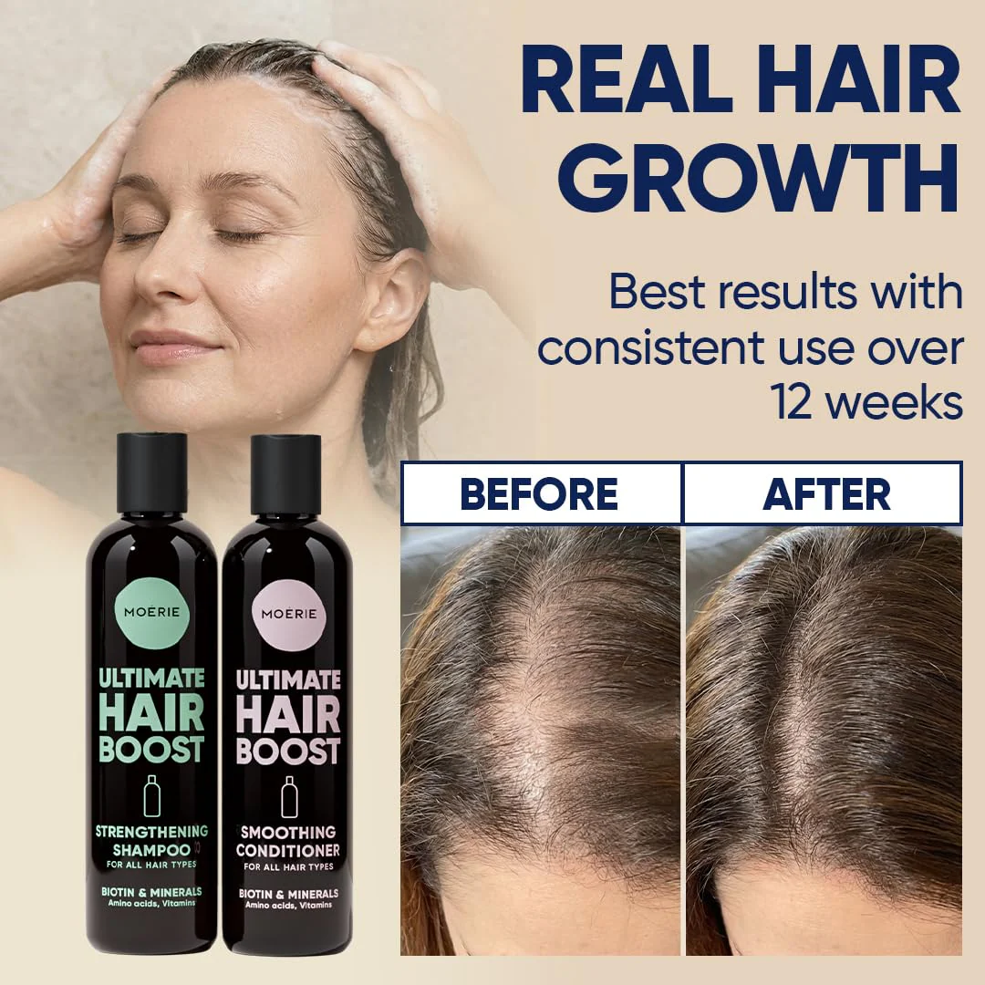 Moerie Hair Growth Shampoo and Conditioner for Women and Men, Hair Loss Solution with Biotin and Rosemary, Thickening Shampoo and Conditioner for Thinning Hair – Promotes Regrowth - Image 3