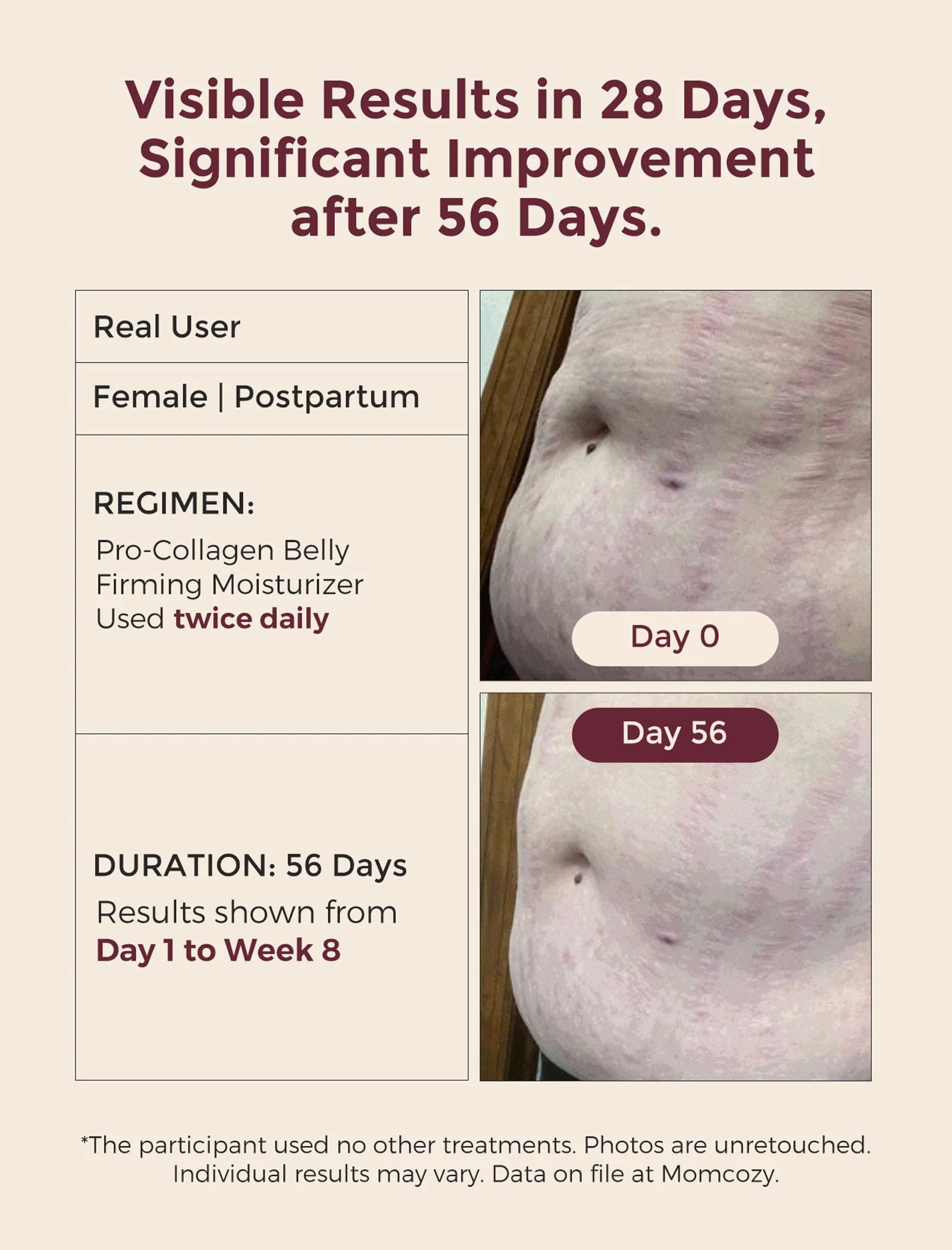 Momcozy Stretch Mark Cream for Pregnancy & Postpartum, Pro-Collagen Belly Firming Moisturizer, Facial-Grade Peptides & Oil-in-Cream, 5.29 oz (150g) - Image 3