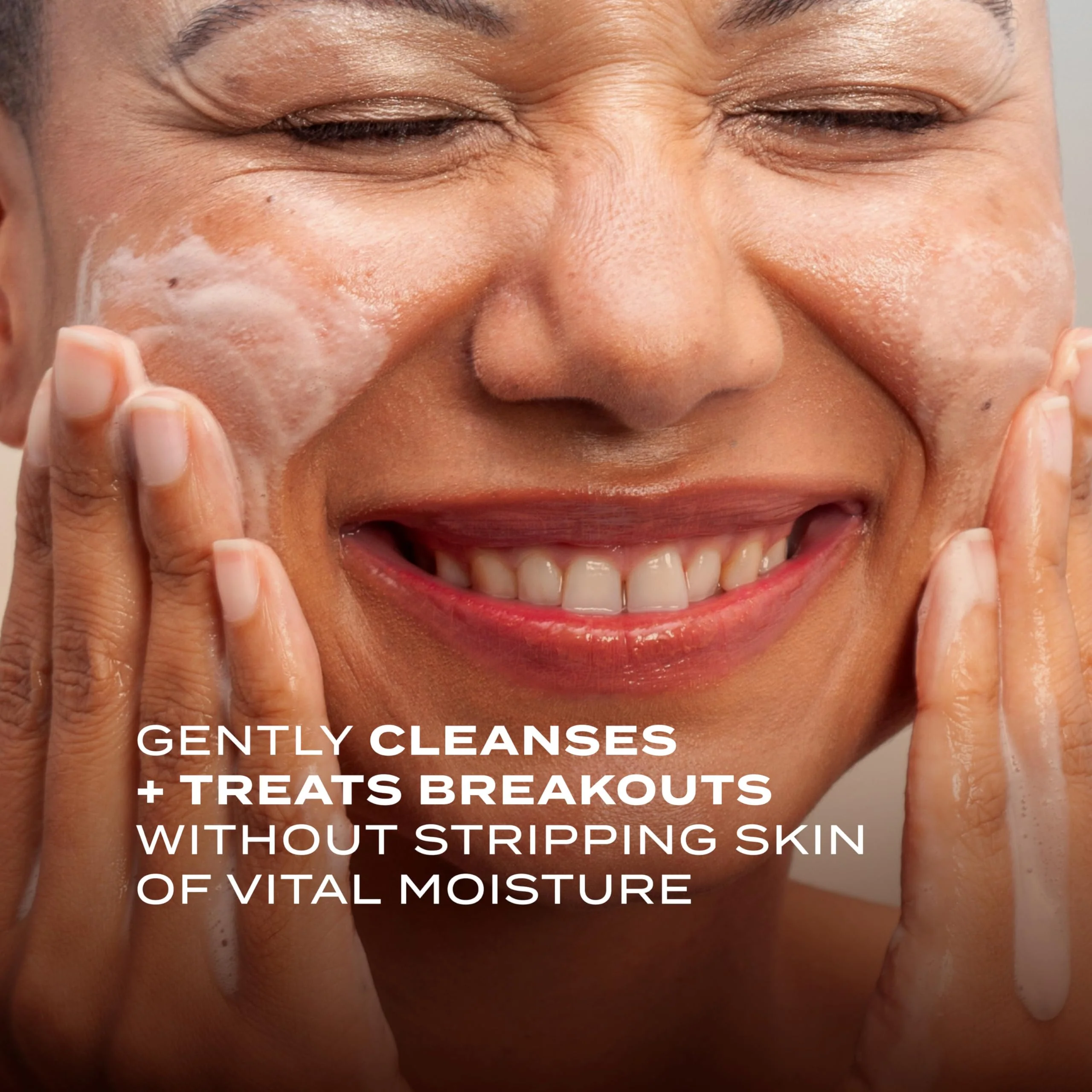 Murad Acne Control Clarifying Cream Cleanser – Gentle Salicylic Acid Face Wash for Acne-Prone and Sensitive Skin, Treats and Prevents Breakouts and Calms Irritation with Extra Hydration – 5 Fl Oz - Image 8