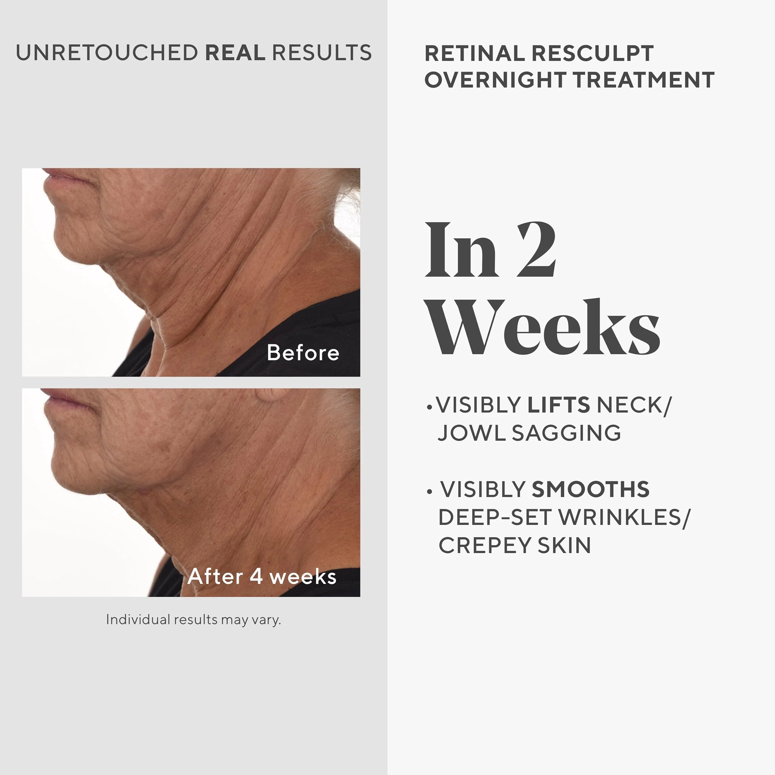 Murad Retinal ReSculpt Overnight Treatment - Advanced Face and Neck Serum with Encapsulated Retinal, Kangaroo Paw, Olive, & Oat Smooths Deep Wrinkles and Crepey Skin, & Lifts Sagging Skin - 1 Fl Oz - Image 10