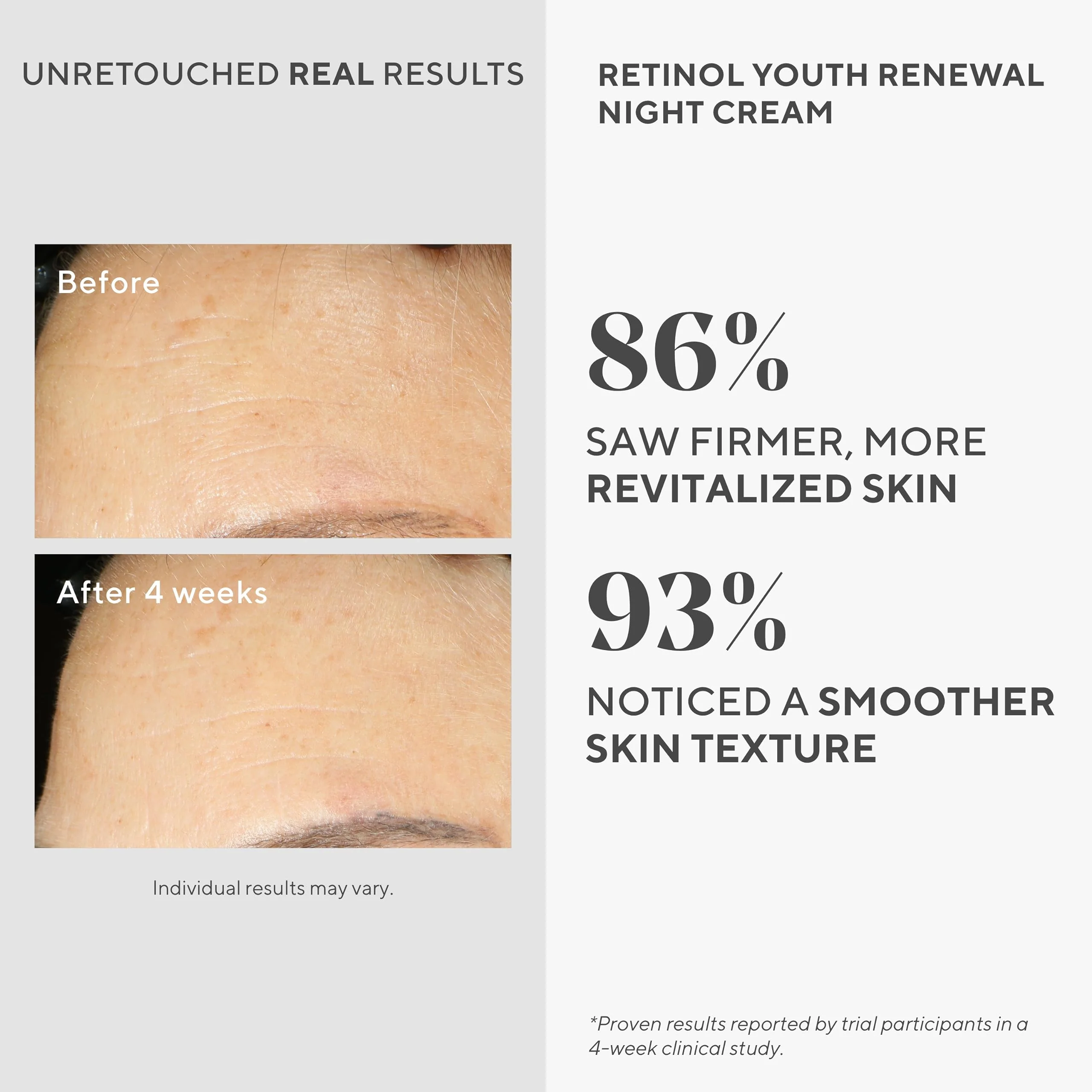 Murad Retinol Youth Renewal Night Cream - Anti-Aging Moisturizer with Retinol Tri-Active Technology and Niacinamide Gently Fights Wrinkles and Fine Lines, Boosts Radiance and Firms Skin - 1.7 Fl Oz - Image 9