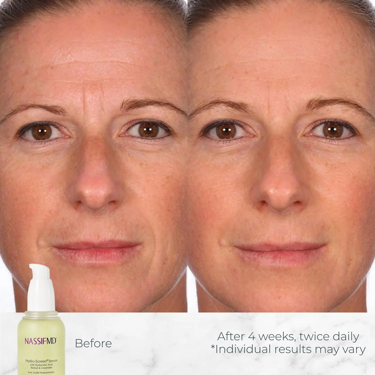NassifMD Hydro-Screen Hydration Serum | Surgeon-Created Hyaluronic Acid, Ceramides & Retinol Formula for Plumping, Firming & Reducing Fine Lines - Image 8