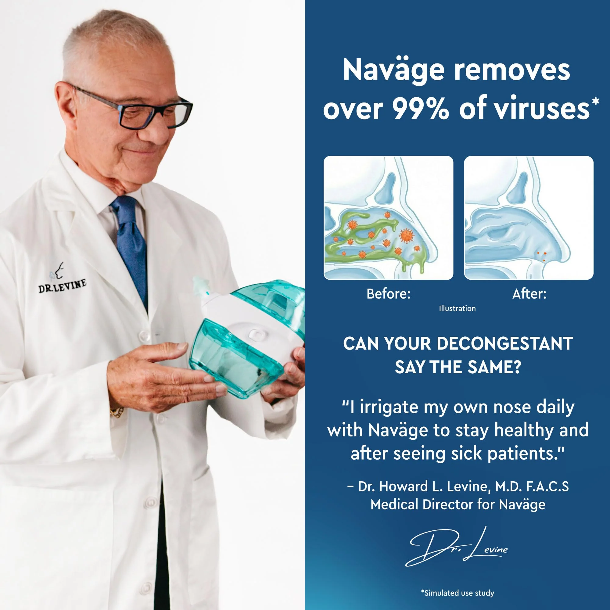 Navage® Nasal Irrigation System Deluxe Bundle, Nose Cleaner for Congestion Relief w/ 30 SaltPods, Storage Caddy, Black Travel Bag & Batteries ($137 Value). Sinus Rinse for Clinically Proven Benefits - Image 3