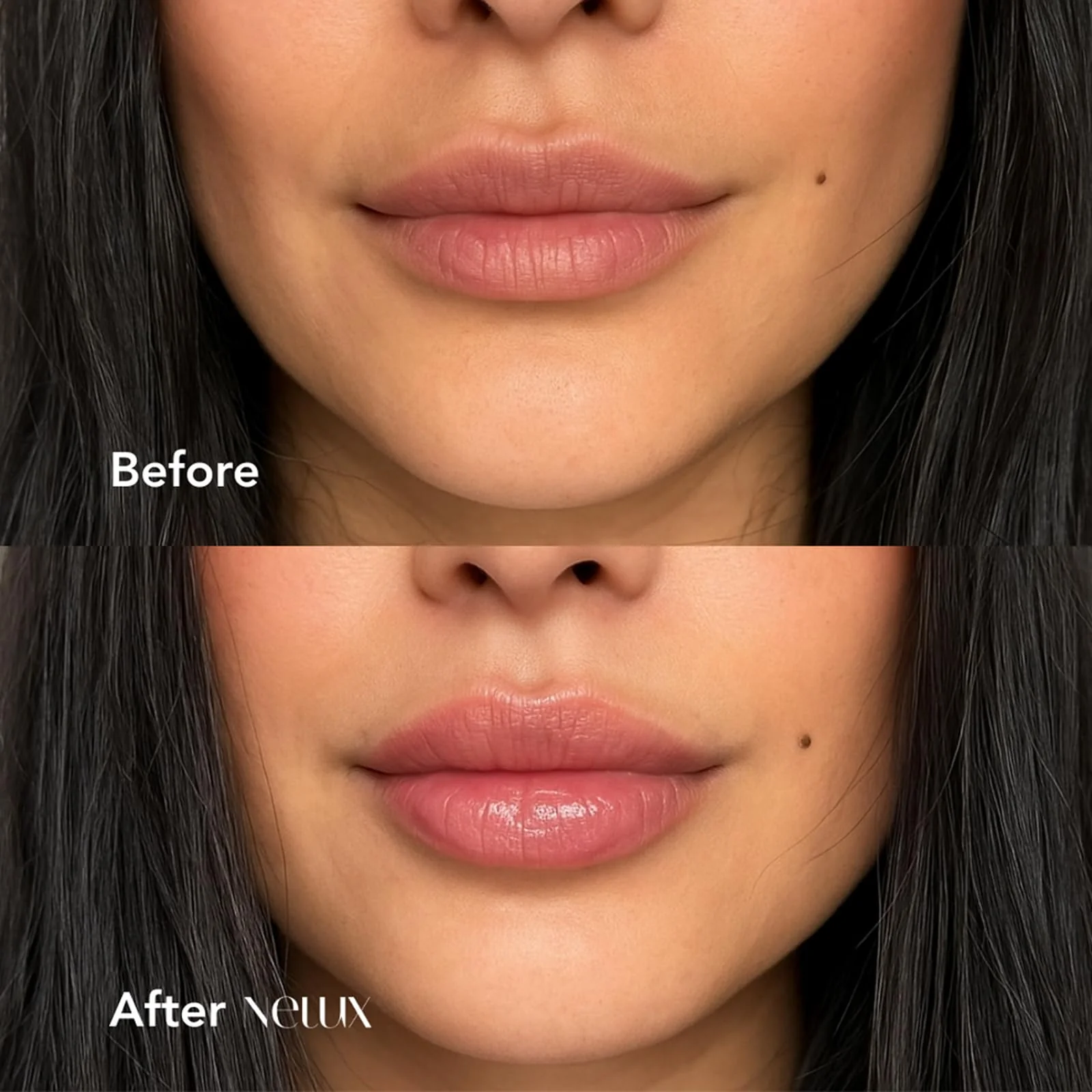 Nelux Lip Plumper, Nelux Hyaluronic Acid Lip Plumper, Instant Hydration While Visibly Cosmetics Boosting Fullness and Smoothness, Natural Lip Plumpers Without Sticky Glosses and Painful Tingles - Image 7