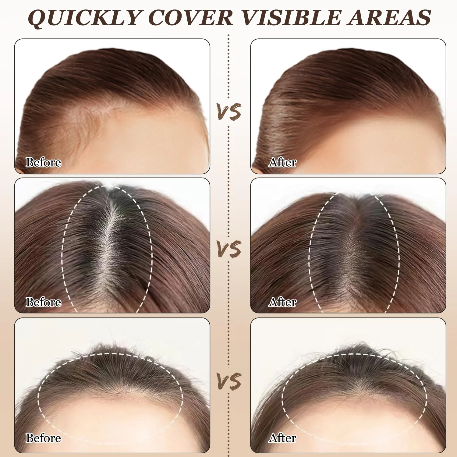 Nicgou Hairline Shadow Powder, Hair Shadow Root Cover Up, Hair Line Concealer Root Cover Up, Unisex Root Touch Up Hair Powder (Dark Brown, 01) - Image 5
