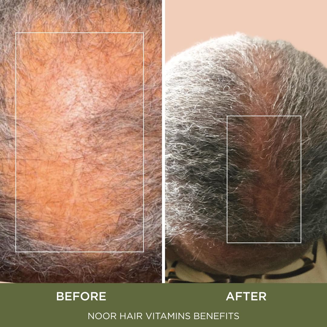 NOOR HAIR Healthy Hair Formula, Hair Growth Supplement Supporting Thick Hair and Fast Hair Regrowth. Vitamin C, B6, Zinc, Propietary Non-GMO & Gluten Free Womens Hair Loss Vitamins - 30 Day Supply - Image 4