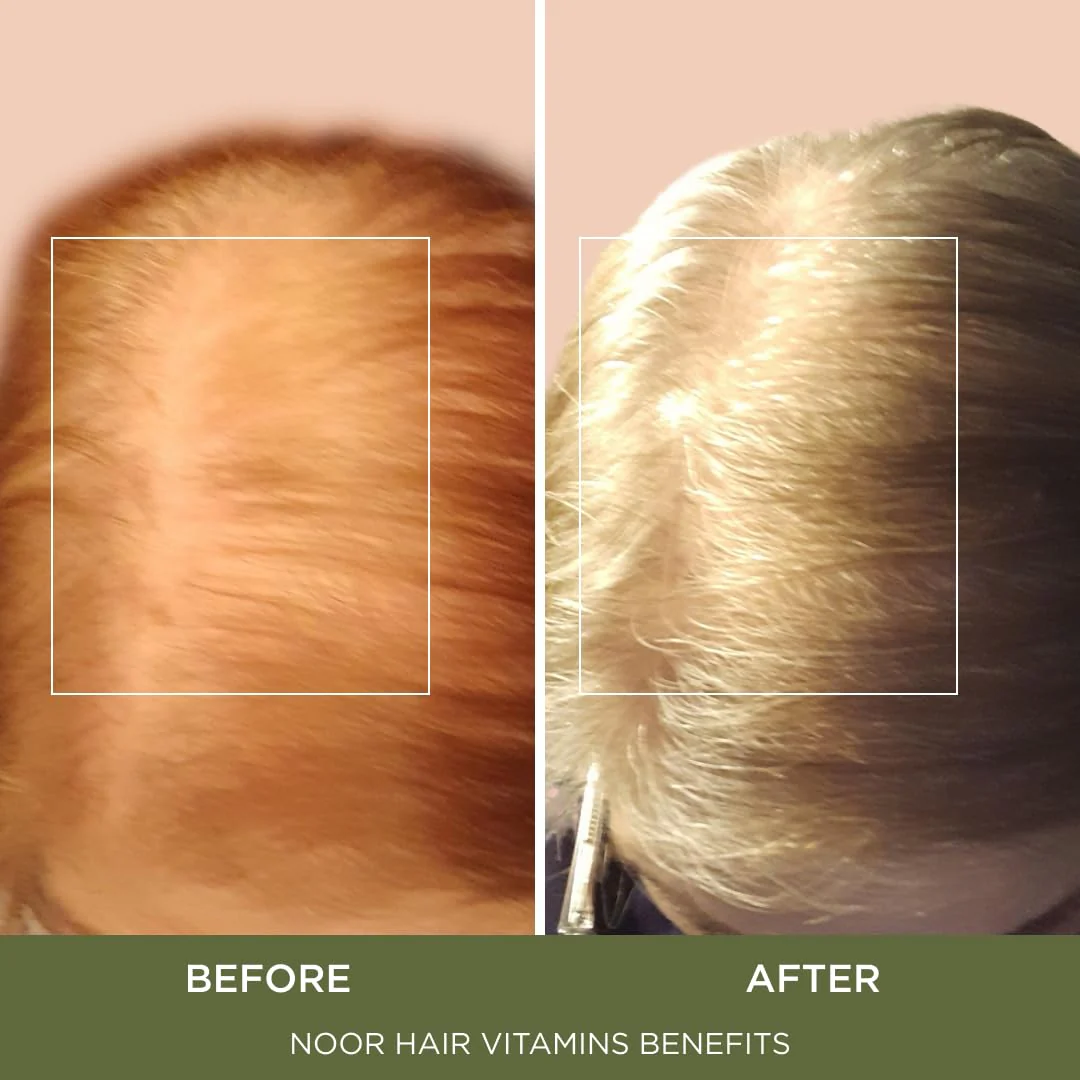 NOOR HAIR Healthy Hair Formula, Hair Growth Supplement Supporting Thick Hair and Fast Hair Regrowth. Vitamin C, B6, Zinc, Propietary Non-GMO & Gluten Free Womens Hair Loss Vitamins - 30 Day Supply - Image 5