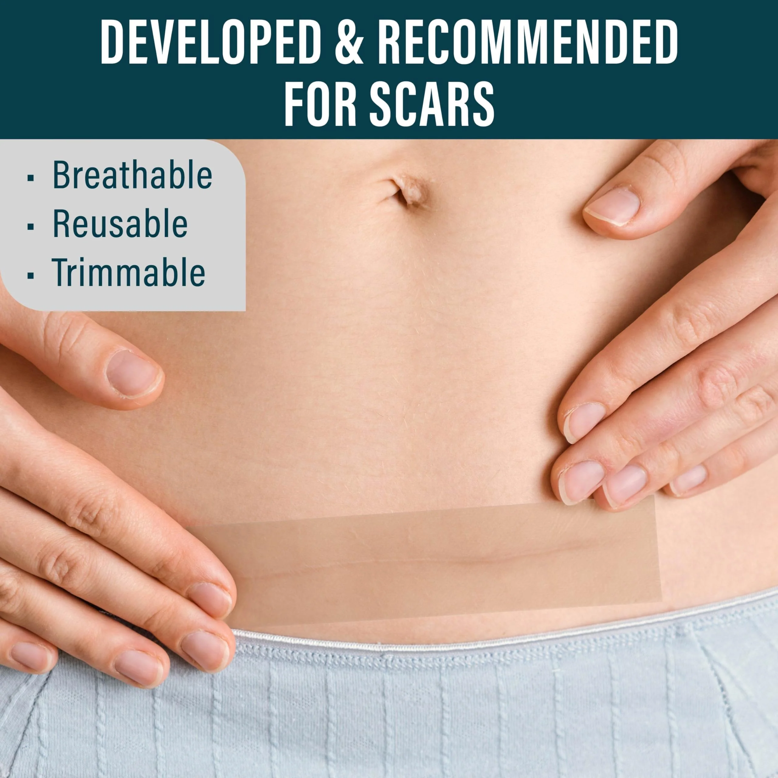 NUVADERMIS Silicone Scar Sheets for Surgical Scars - 120" x 1.5" Roll - Medical Grade Silicone Scar Tape and Face Tape for Wrinkles, Keloid Scars, and Hypertrophic Scars - Reusable - 1 Pack - Image 4