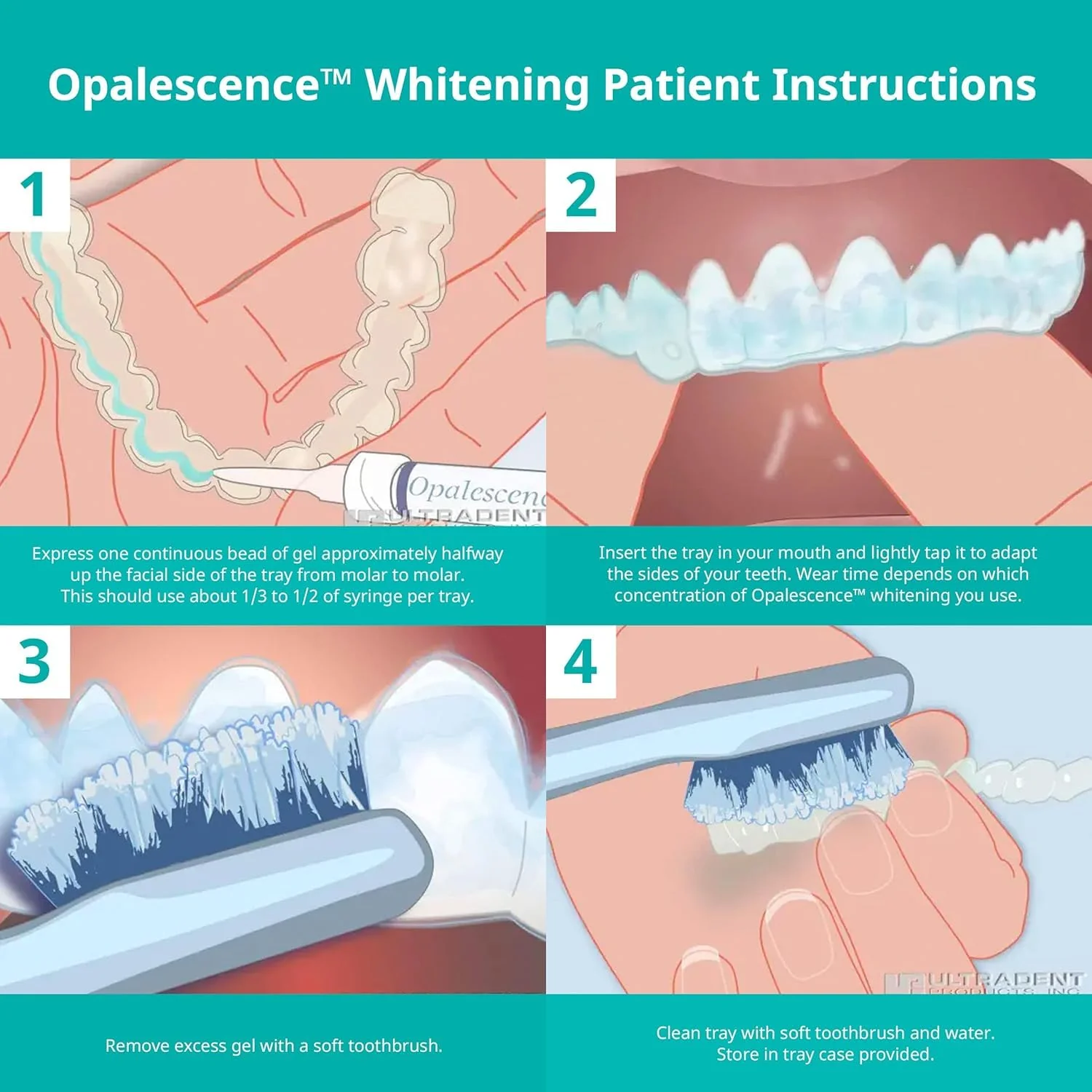 Opalescence 35% CP Mint - Gel Syringes Teeth Whitening - Refill Kit - Carbamide Peroxide Gel. Made by Ultradent. Tooth Whitening Refill Syringes 5197 (0.04 Fl Oz (Pack of 4)) - Image 6