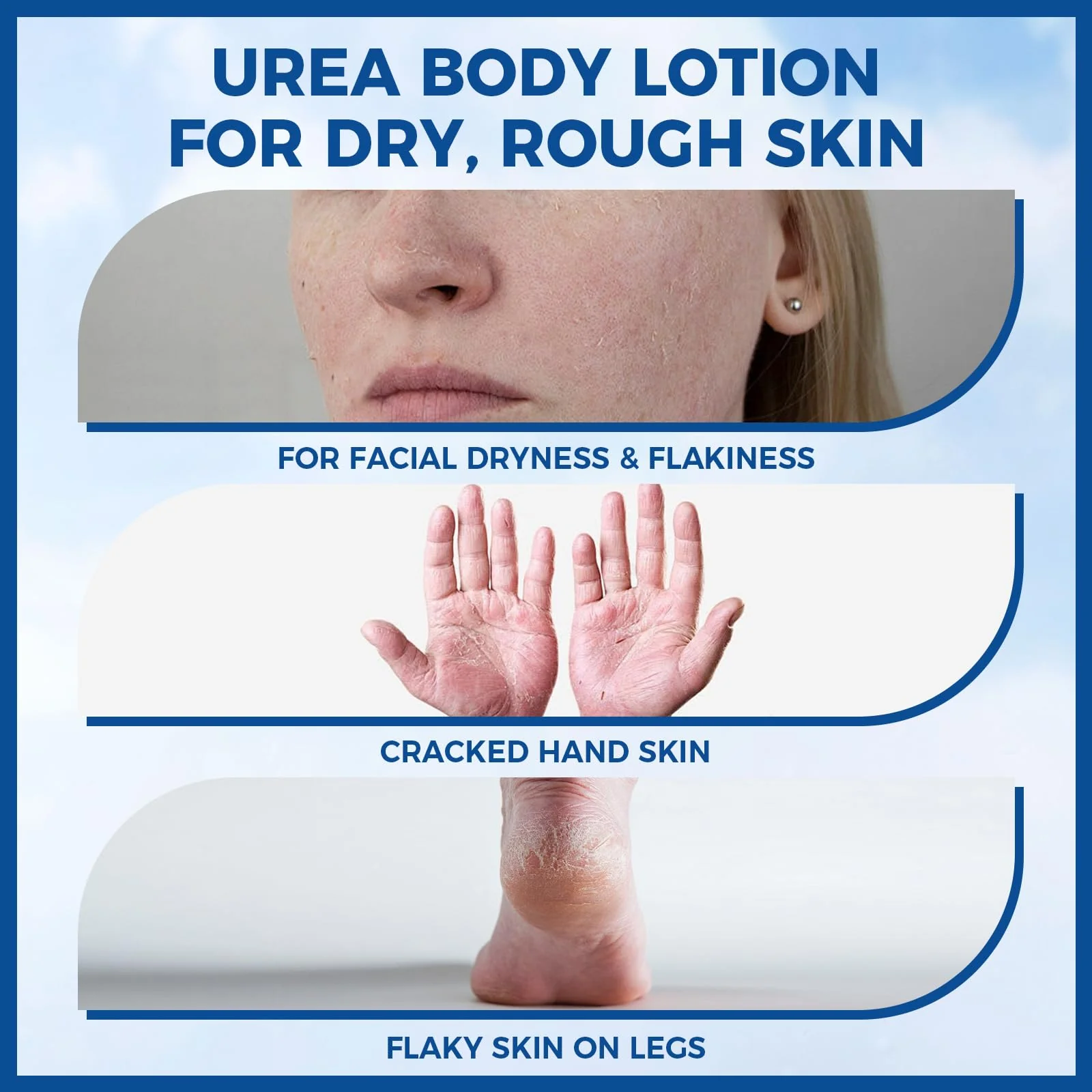 OUKEYA Urea Cream for Dry Chapped Skin with 10% Urea Deep Moisturizer Body Lotion, Softens & Soothes Hands Elbows Feet Hydrates Locks in Moisture, Fast Absorbing & Non-Greasy, 11.28 oz Large Capacity - Image 7