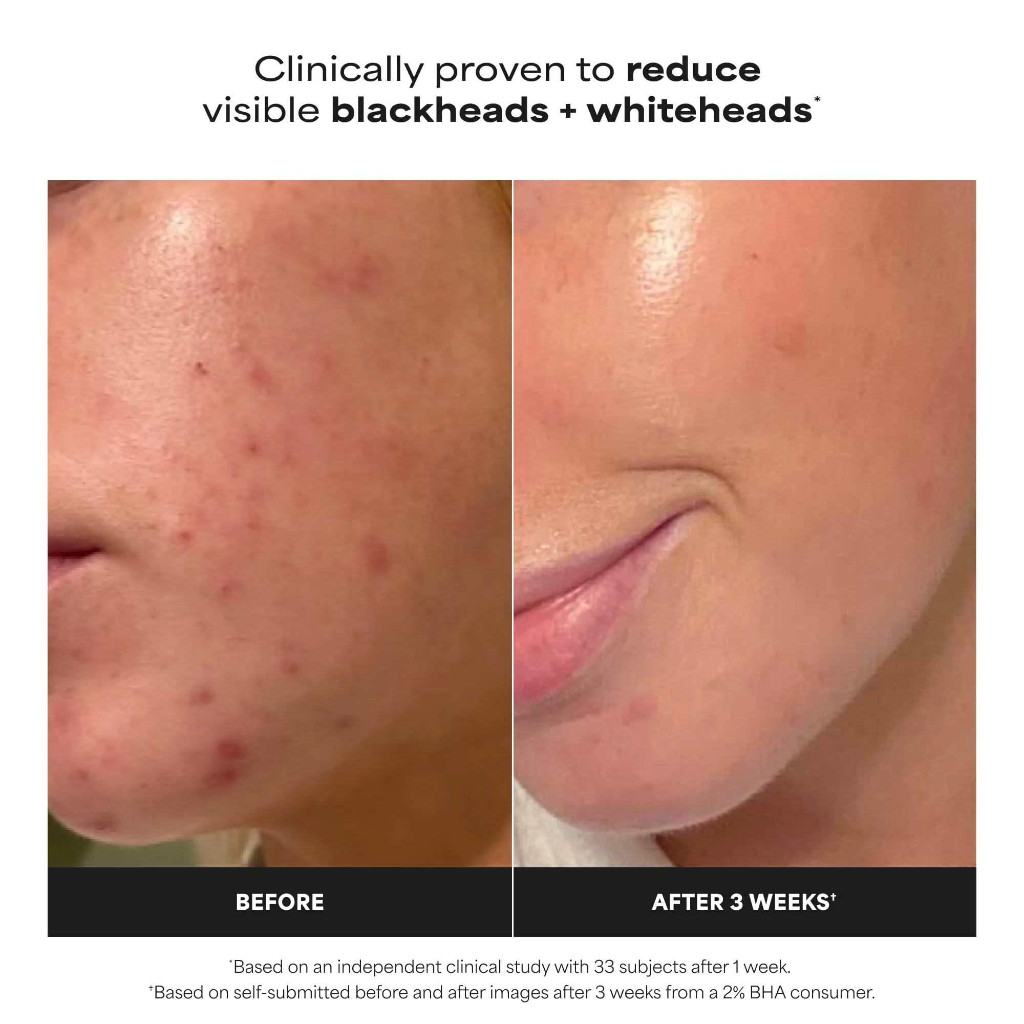 Paula's Choice SKIN PERFECTING 2% BHA Liquid Exfoliant with Salicylic Acid, Facial Polish for Pores, Wrinkles & Fine Lines, Suitable for Blackhead-Prone Skin, Fragrance-Free (5 Fl Oz (Pack of 2)) - Image 3