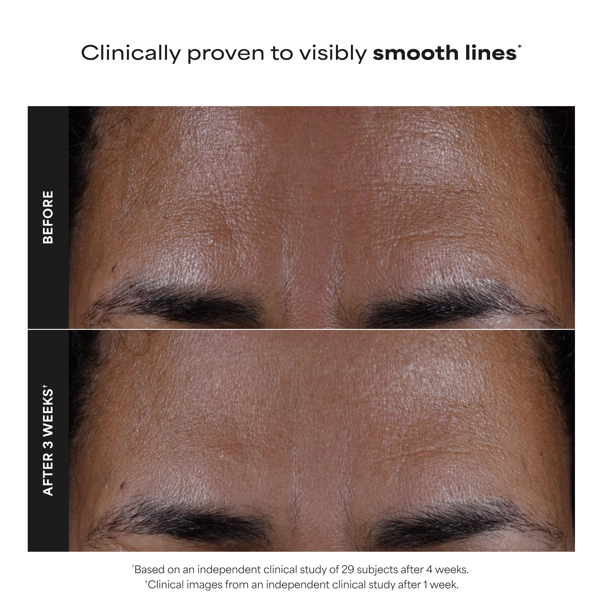Paula's Choice SKIN PERFECTING 2% BHA Liquid Exfoliant with Salicylic Acid, Facial Polish for Pores, Wrinkles & Fine Lines, Suitable for Blackhead-Prone Skin, Fragrance-Free (5 Fl Oz (Pack of 2)) - Image 4