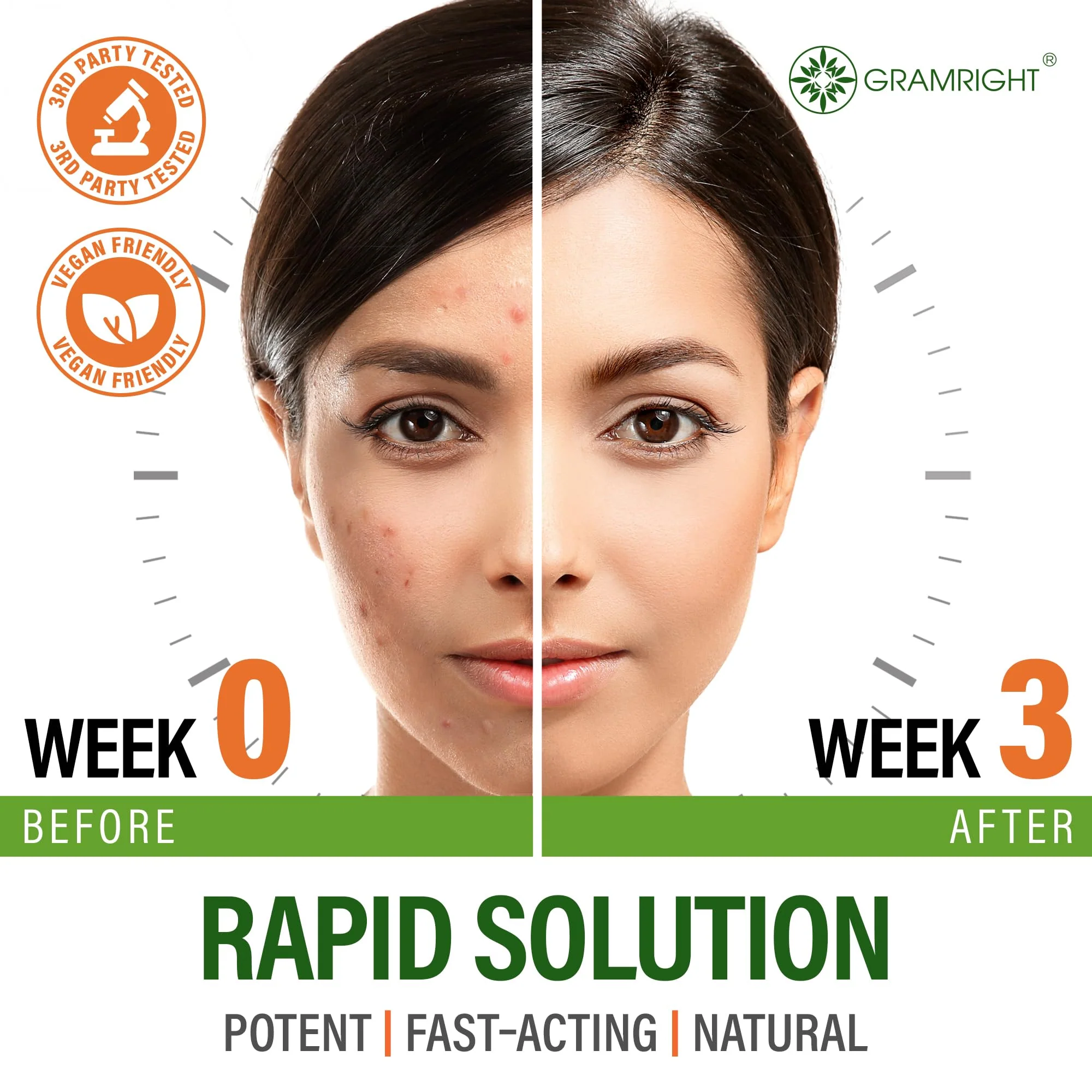 Perfect Skin Acne Pills - Clear Skin Supplement with Niacinamide, Probiotic, Zinc & Vitamin A - Anti Acne Vitamins for Teens, Men & Women - Support for Face & Back Acne, Acne Scars - 60 Capsules - Image 3