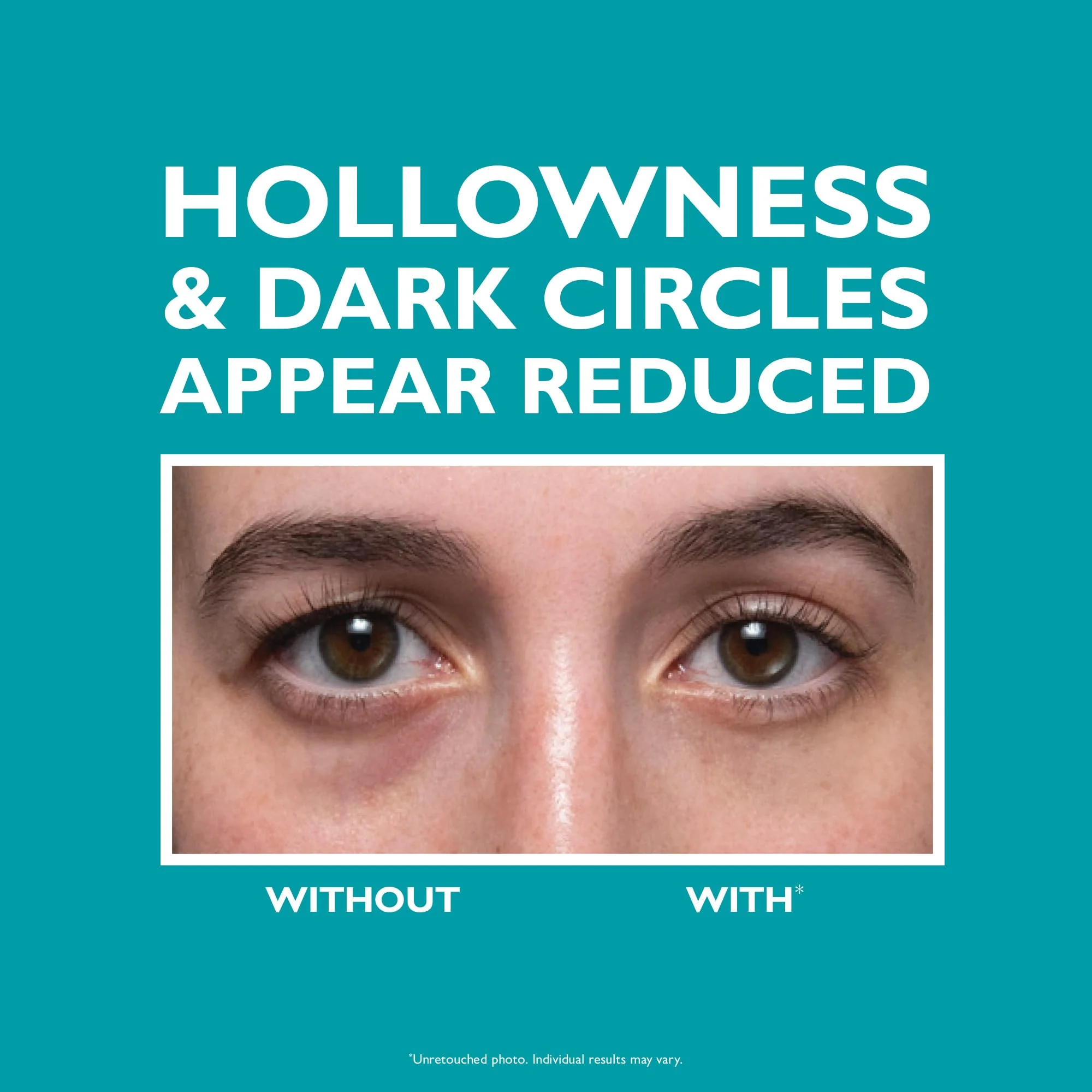 Peter Thomas Roth | Peptide Skinjection Fill + Fix Under-Eye Cream - Image 5