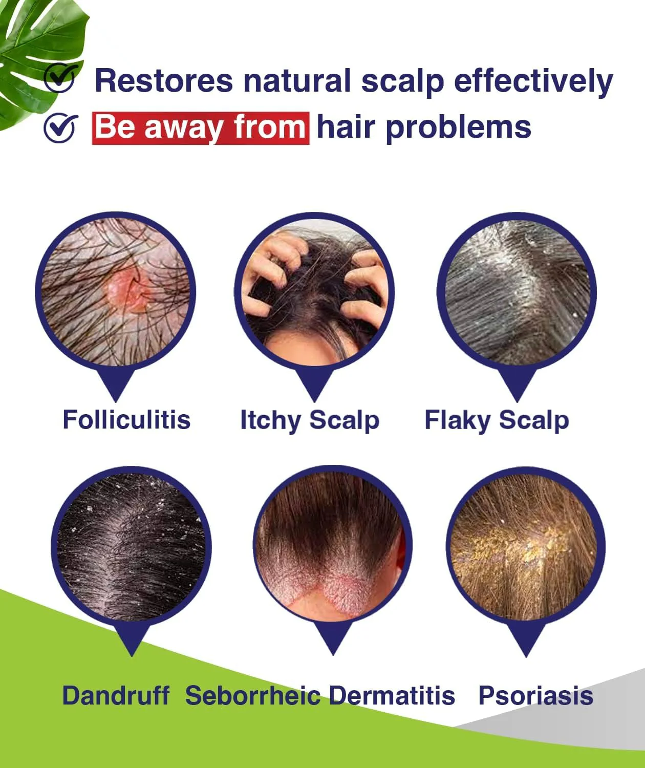 PHARMBANNER Anti-Fungal Shampoo for Folliculitis, Seborrheic Dermatitis, Scalp Psoriasis - Relieves Itchy & Dry Scalp - Image 9