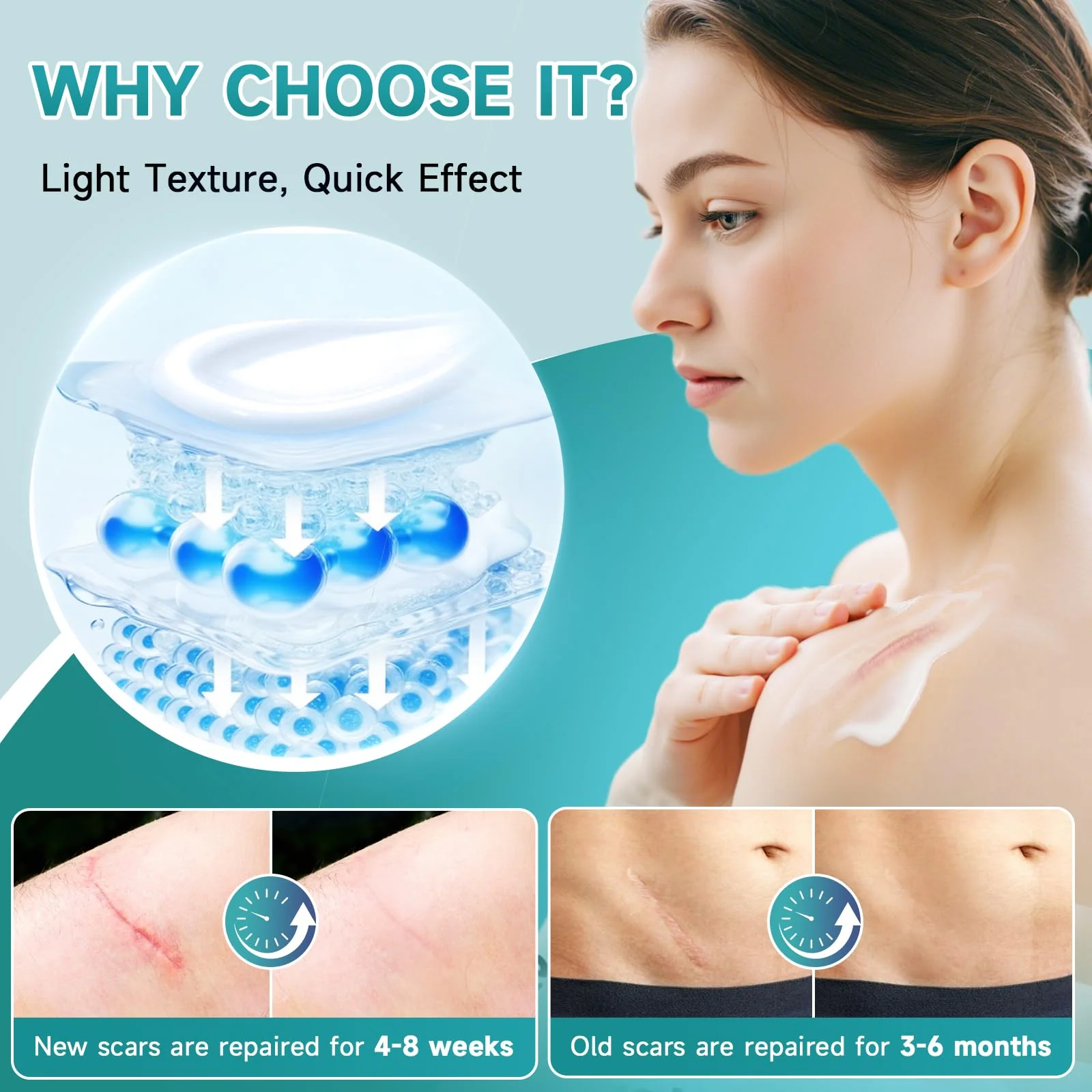 Pumkot Advanced Scar Cream, Silicone Gel for Scars, Professional Scar Removal Cream for Surgical Scars, Stretch Marks, Old and New Scars 1.7 oz(50ml) - Image 4
