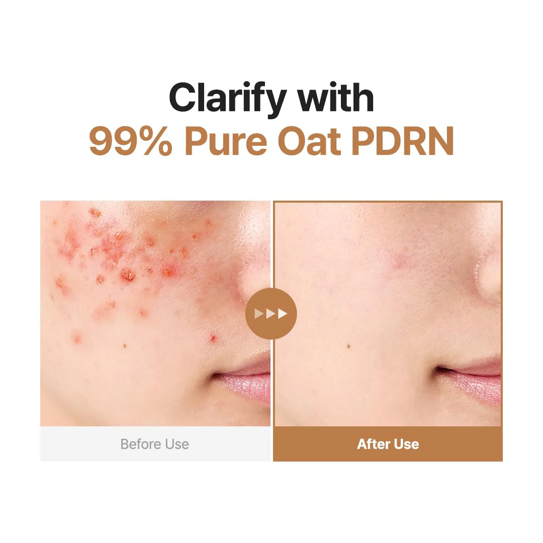 PURITO Oat PDRN Gentle Refining Toner 200 mL 6.76 fl.oz, Korean Oat Exfoliating Toner 99% Pure Oat PDRN, Hydrating & Clarifying Formula for Acne-Prone Skin, Vegan, Non-Comedogenic, Gentle Daily Use - Image 7