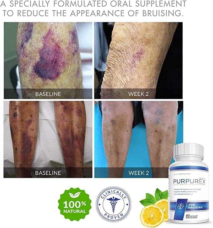 PURPUREX - Dietary Supplement for Bruising (30-Day Supply) - Image 3