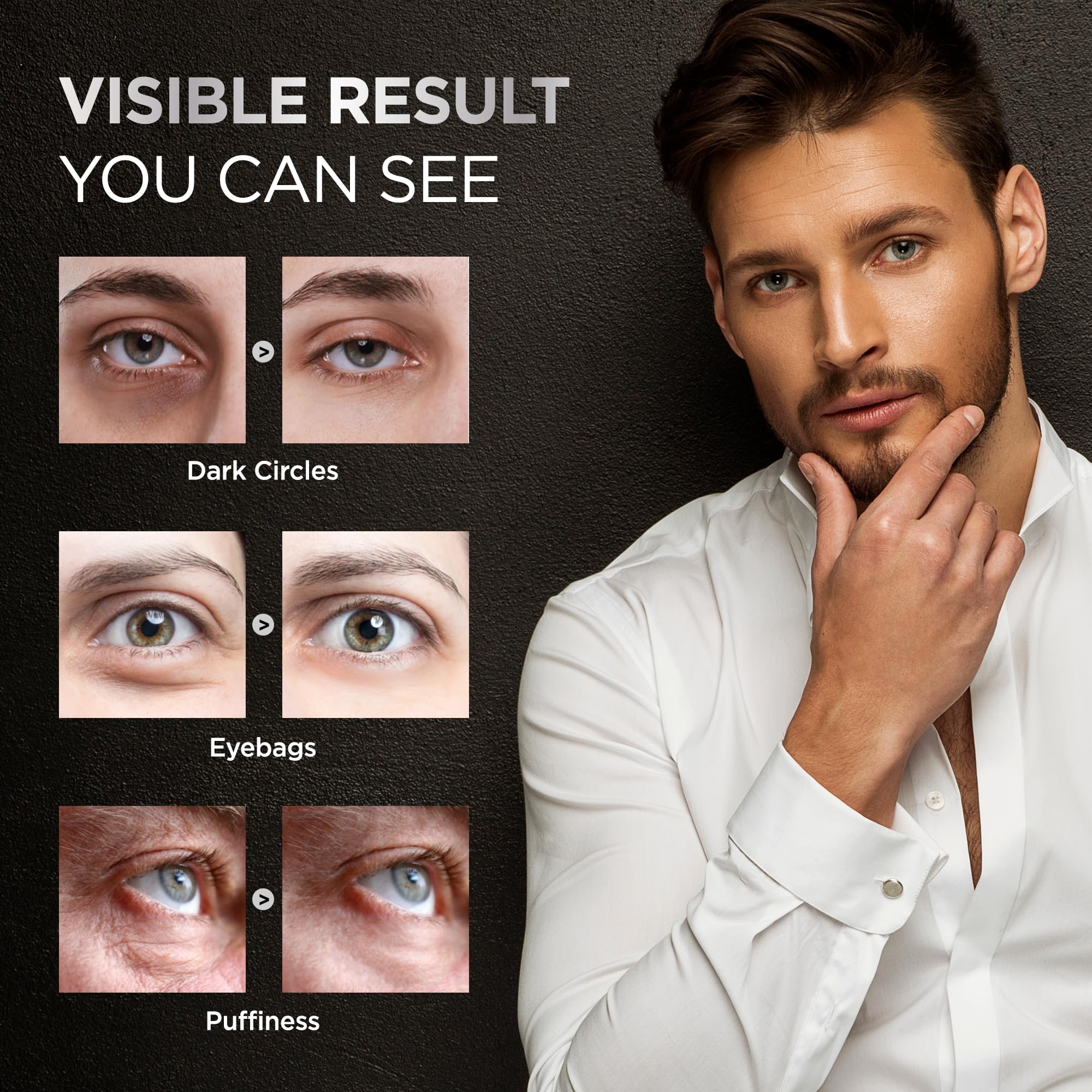 RAZONIX Eye Bags Treatment for Men: Caffeine Eye Roller for Puffy Eyes and Puffiness – Under Eye Cream for Dark Circles (Medium, Unscented) - Image 5