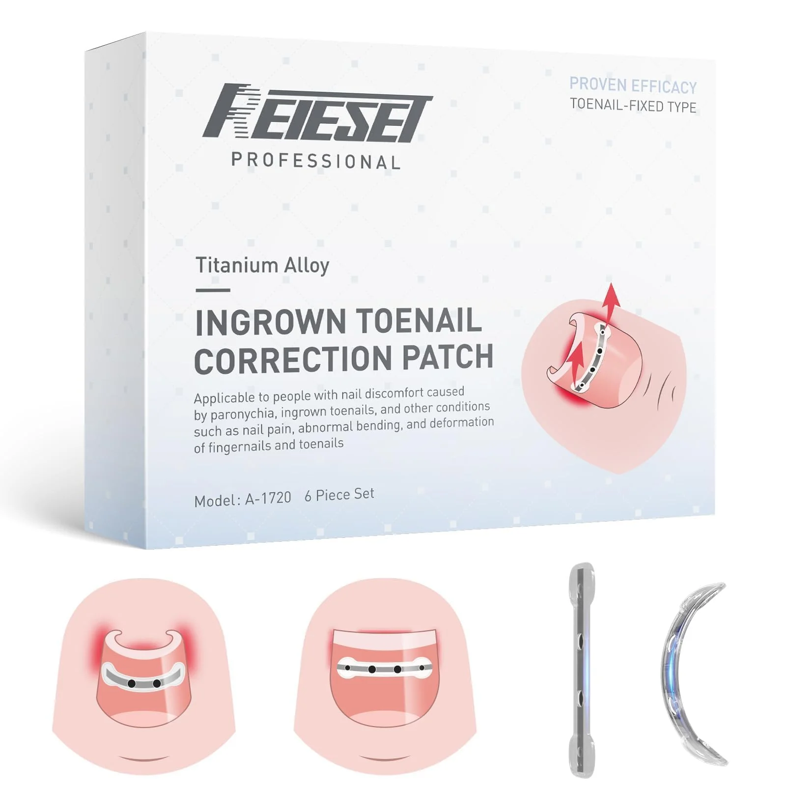 Reieset Titanium Alloy Ingrown Toenail Treatment, Nail Tools, and Ingrown Toenail Removal Kit Specially Designed for Curved Nail Repair and Ingrown Toenail Corrector (0.59/0.67in) - Image 2
