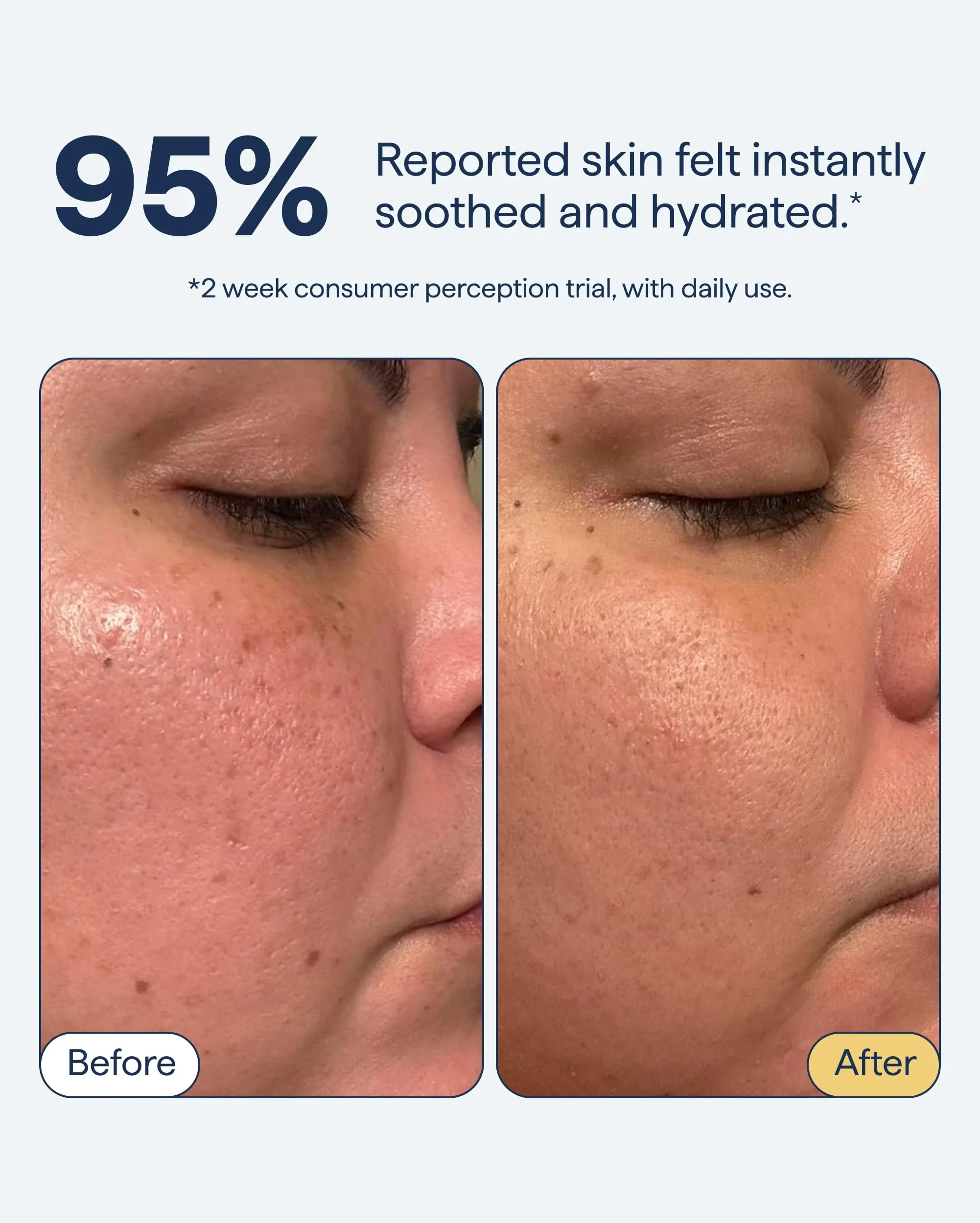 Remedy for Light Moisture | Barrier Repairing Hydrating Lightweight Gel Moisturizer Water Cream for Normal to Oily Skin | By Dermatologist Dr. Shah, 1.7 fl. Oz - Image 8