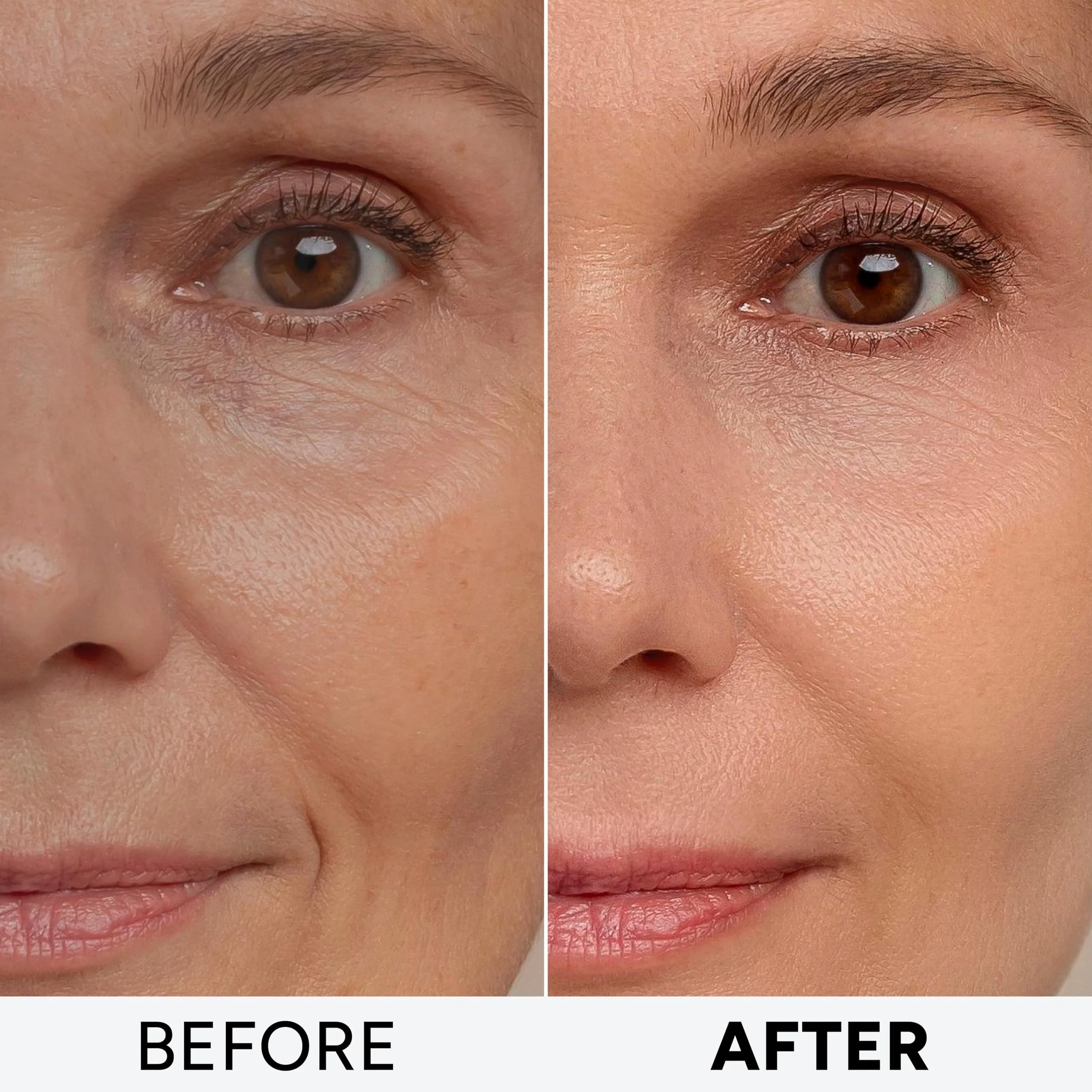 Retinol Cream for Face with Collagen Peptides - Anti Aging Wrinkle Cream for Women and Men - Day-Night Facial Moisturizer with Hyaluronic Acid - Tightening and Skin Firming - Neck & Décolleté - Image 6